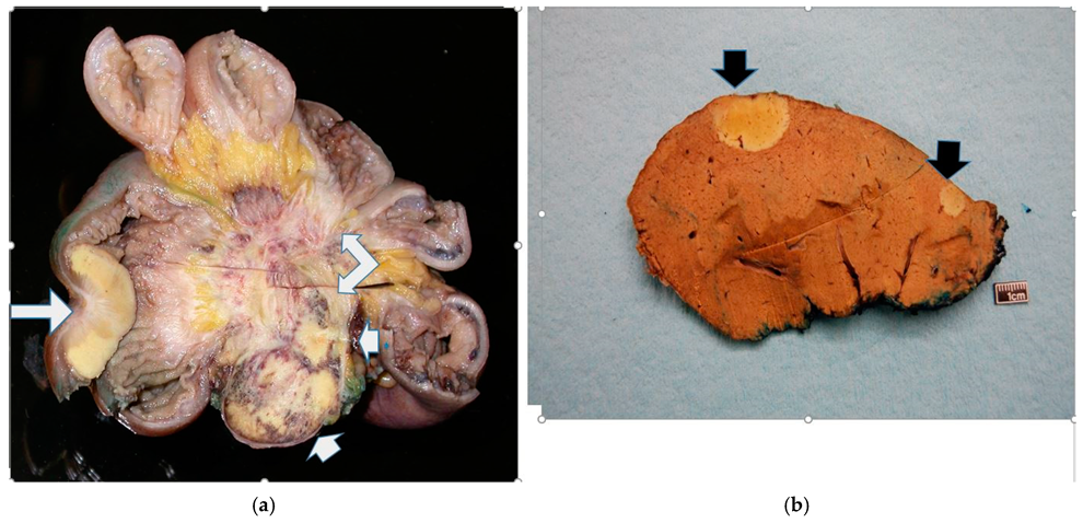 Cancers 17 01486 g001 Cancers 17 01486 g001