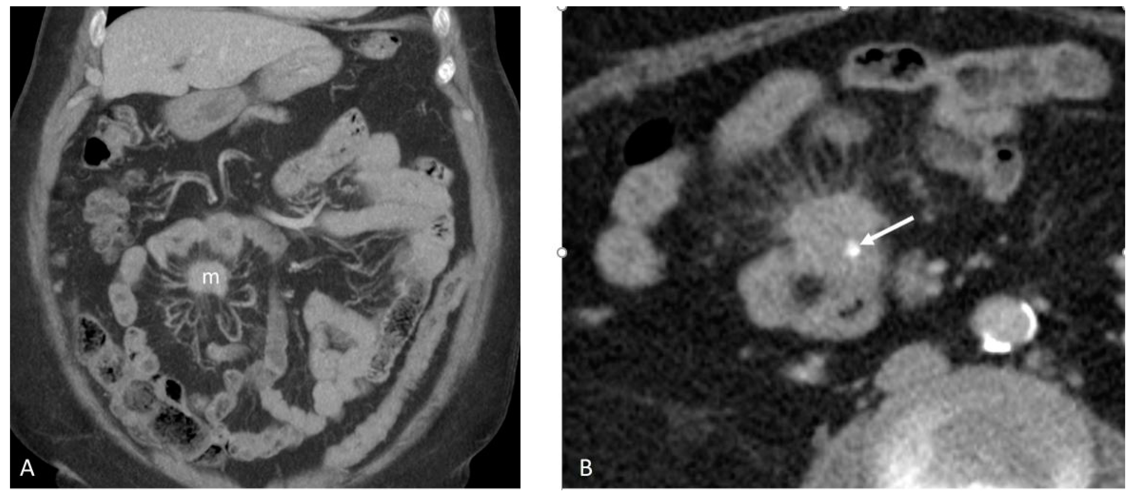 Cancers 17 01486 g002 Cancers 17 01486 g002