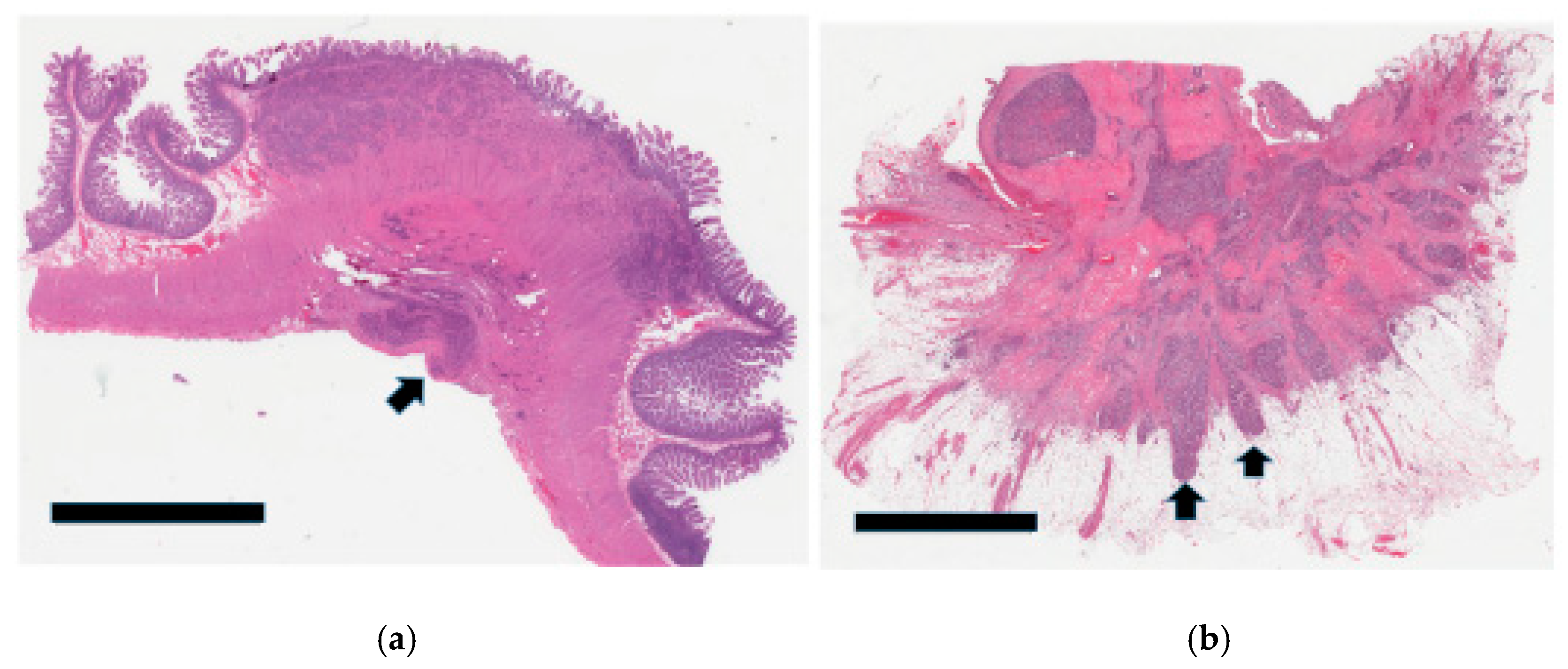 Cancers 17 01486 g004 Cancers 17 01486 g004