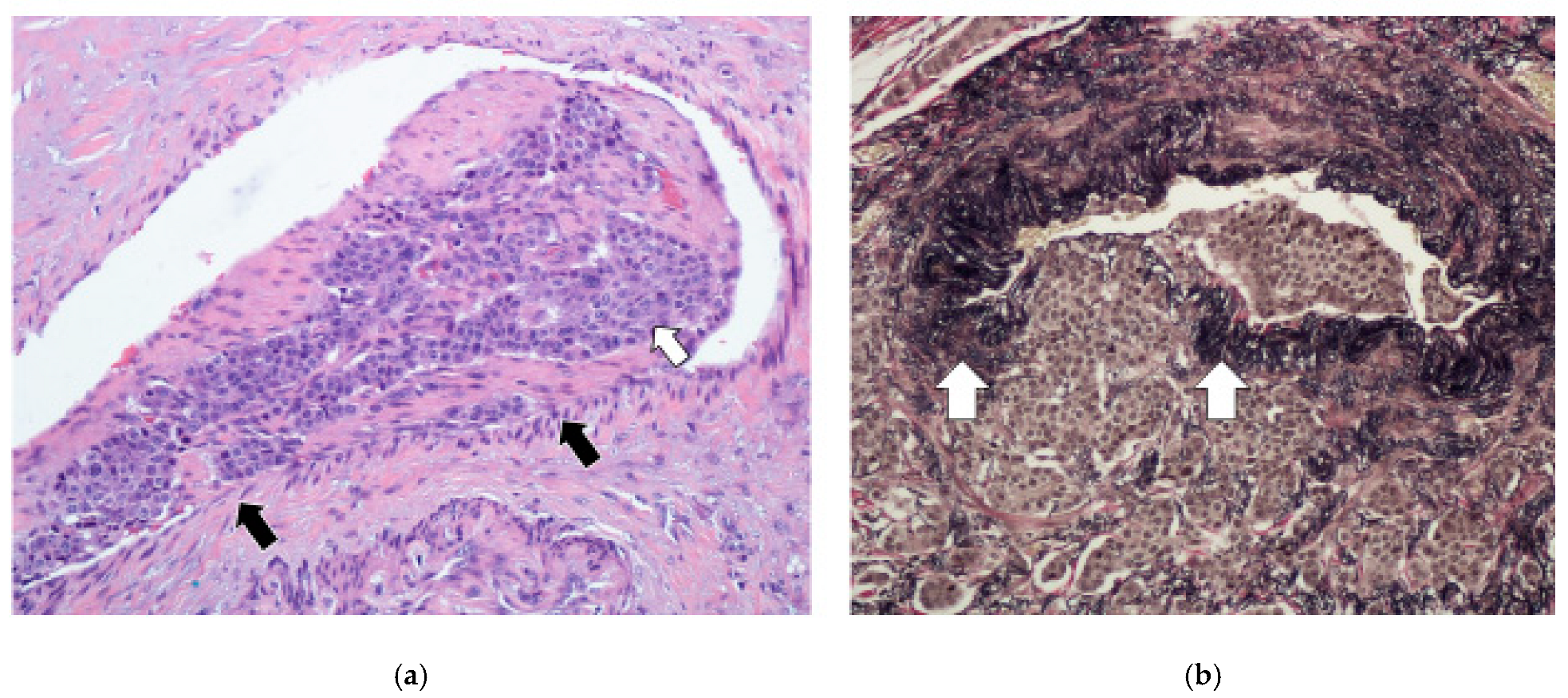 Cancers 17 01486 g006 Cancers 17 01486 g006