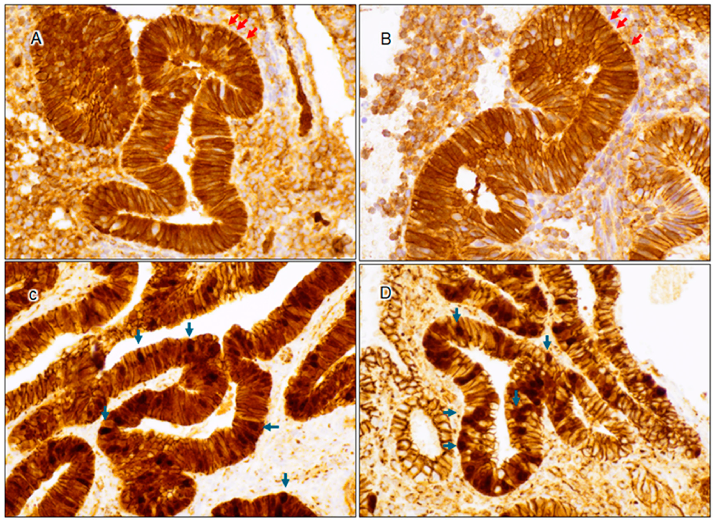 Cancers 17 01495 g002