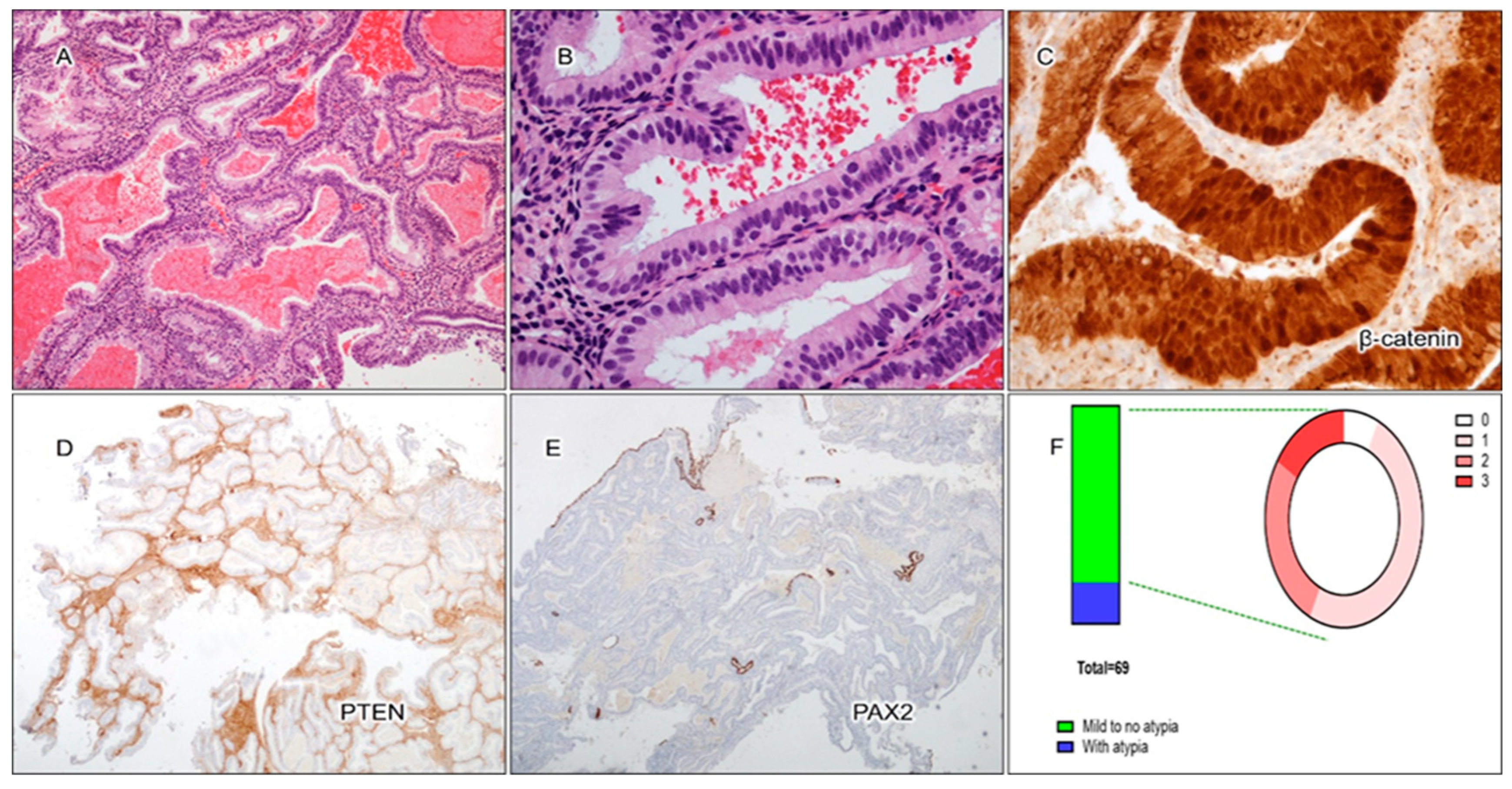 Cancers 17 01495 g004