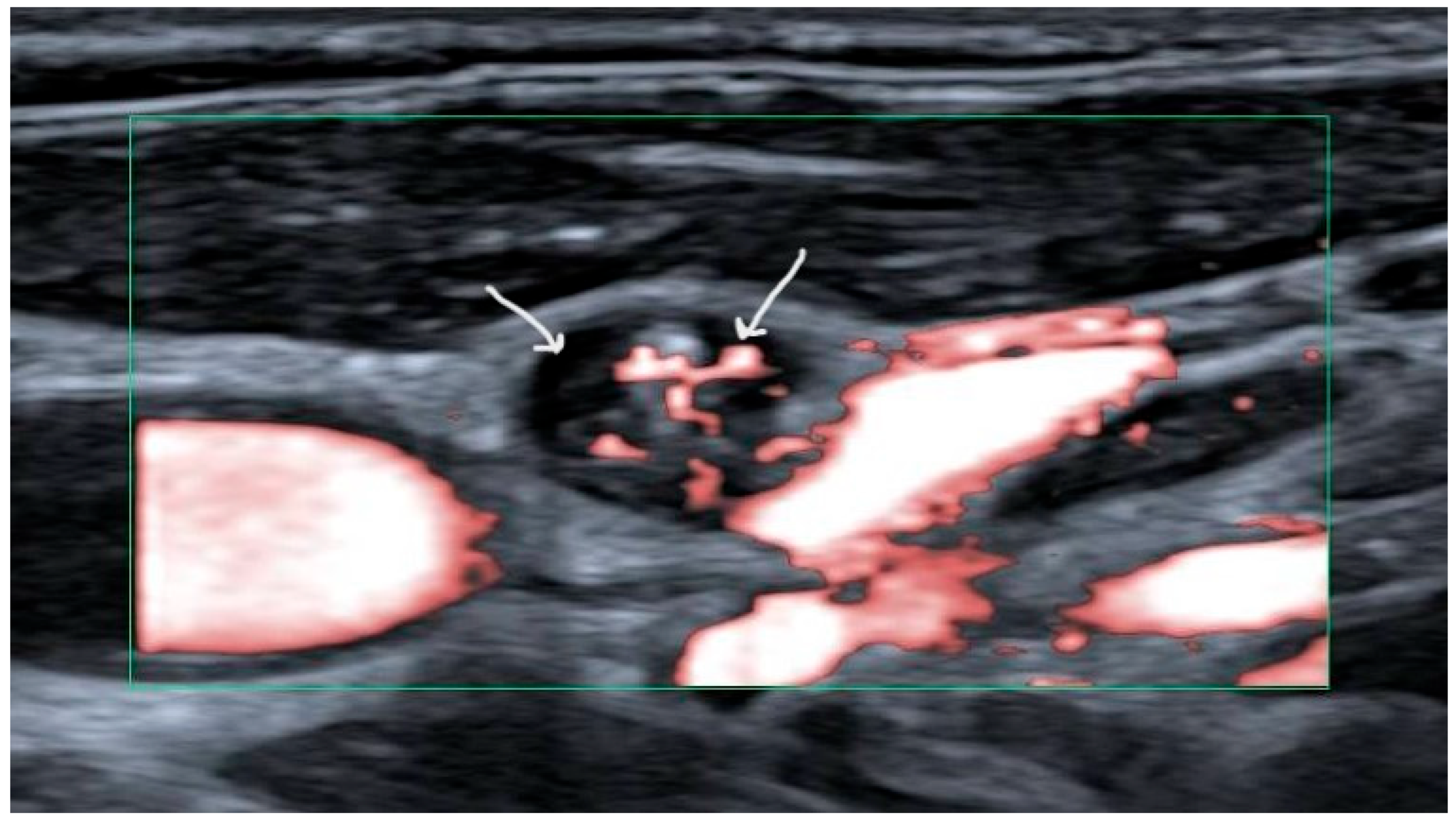 Cancers 17 01497 g001