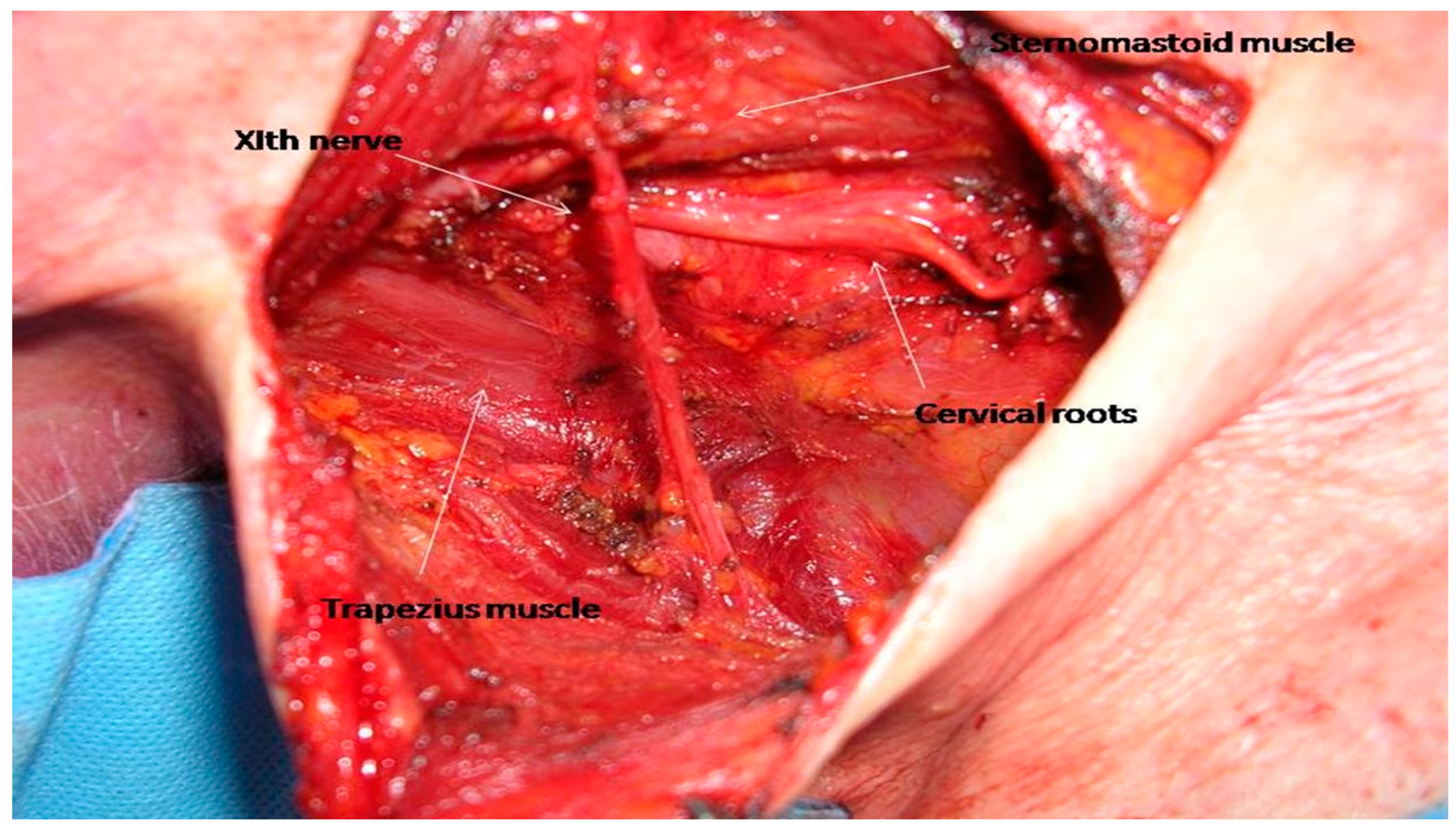 Cancers 17 01497 g002
