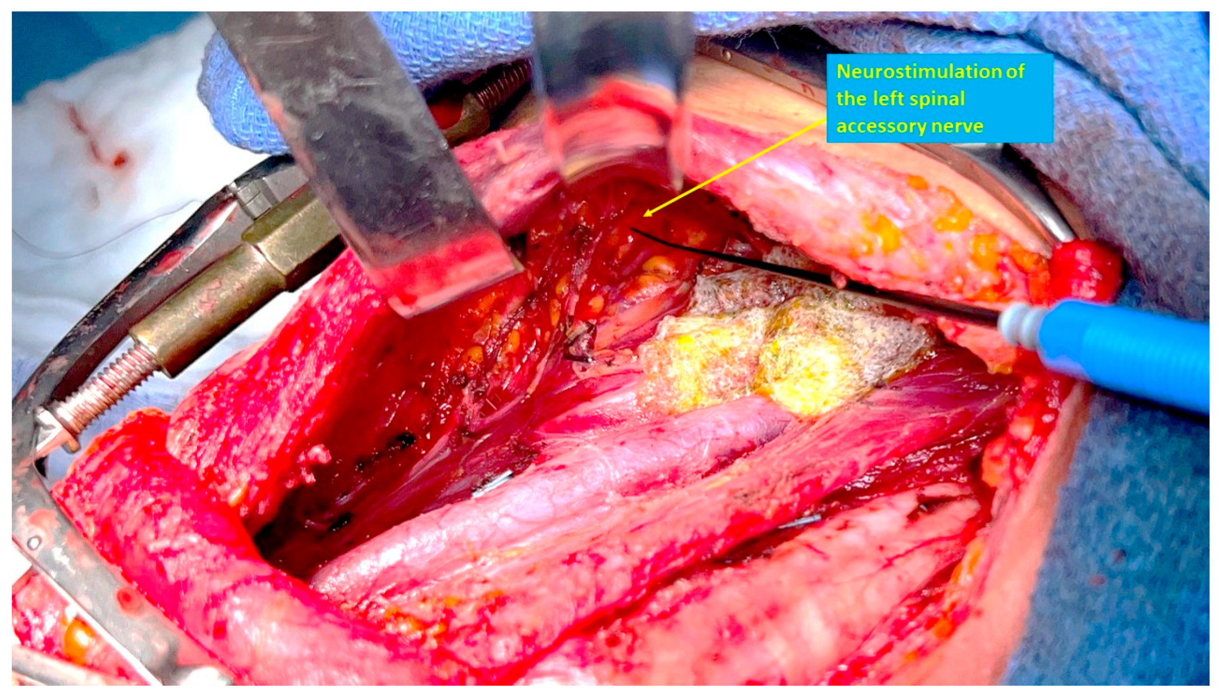 Cancers 17 01497 g003