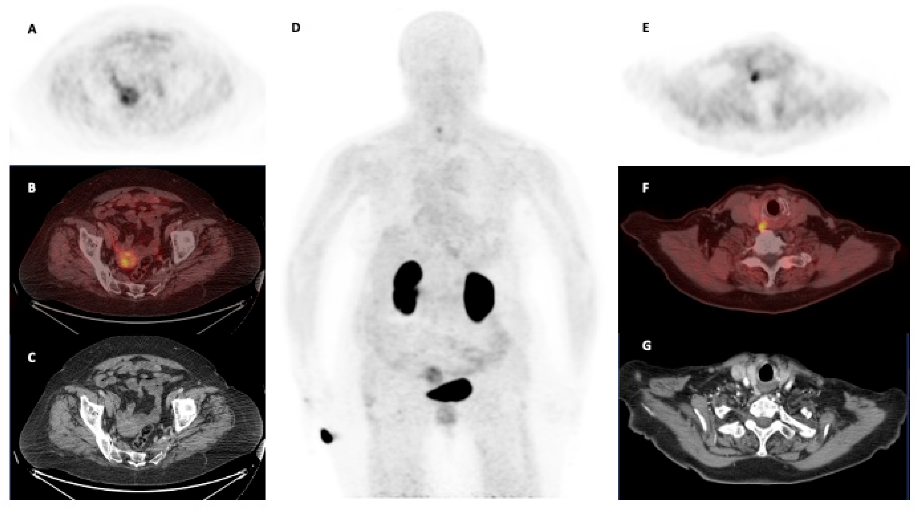 Cancers 17 01504 g004