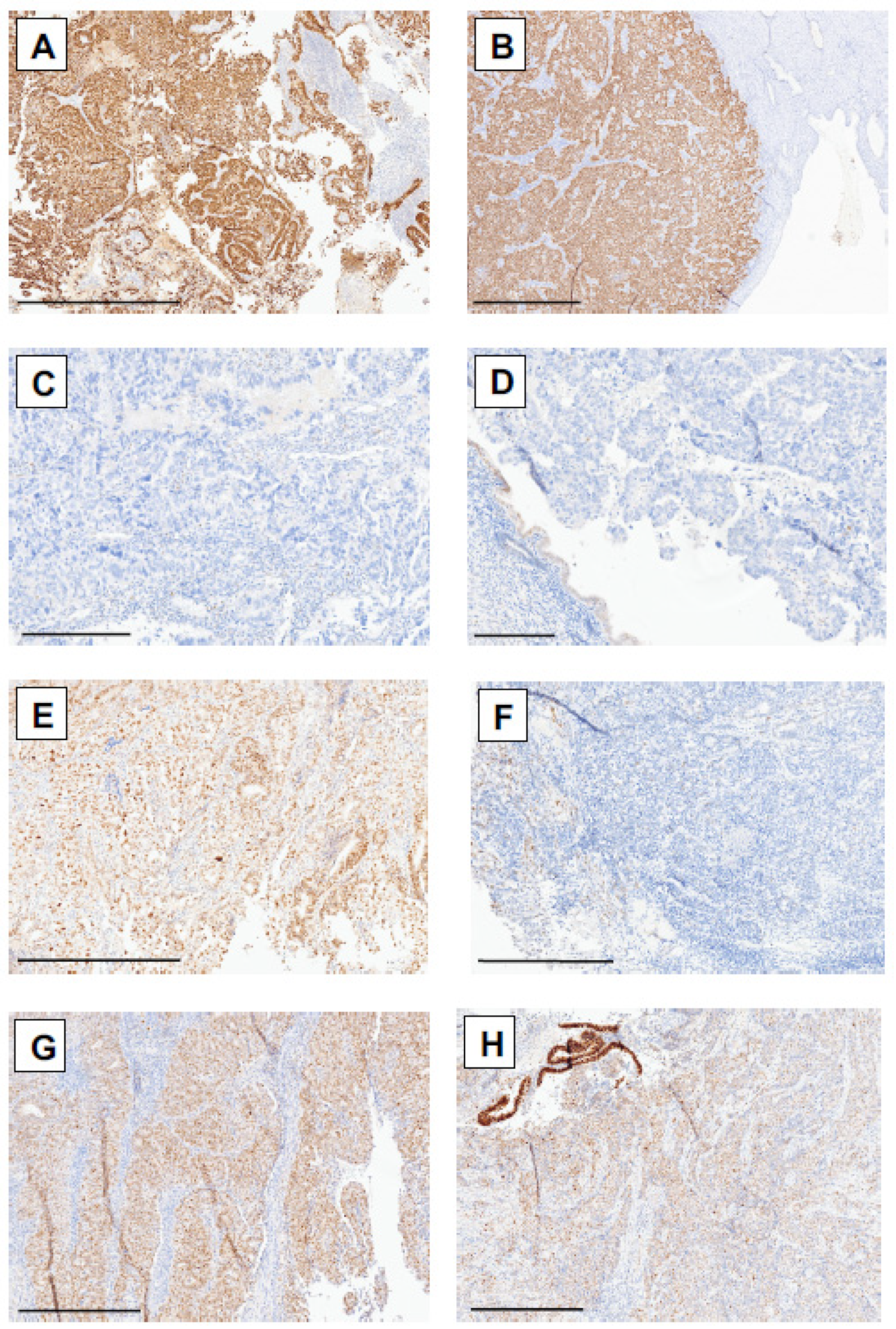 Cancers 17 01506 g002