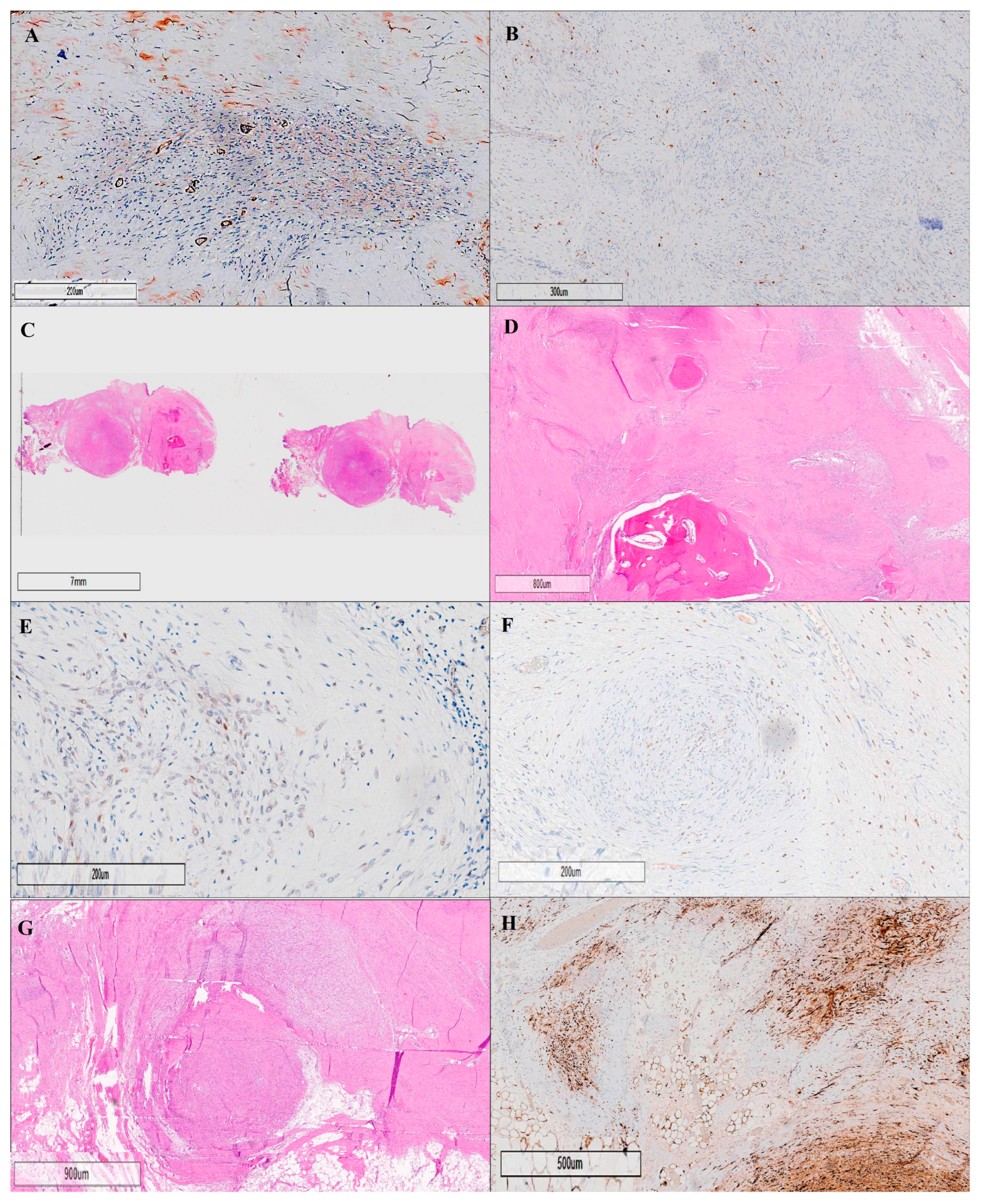 Cancers 17 01508 g004