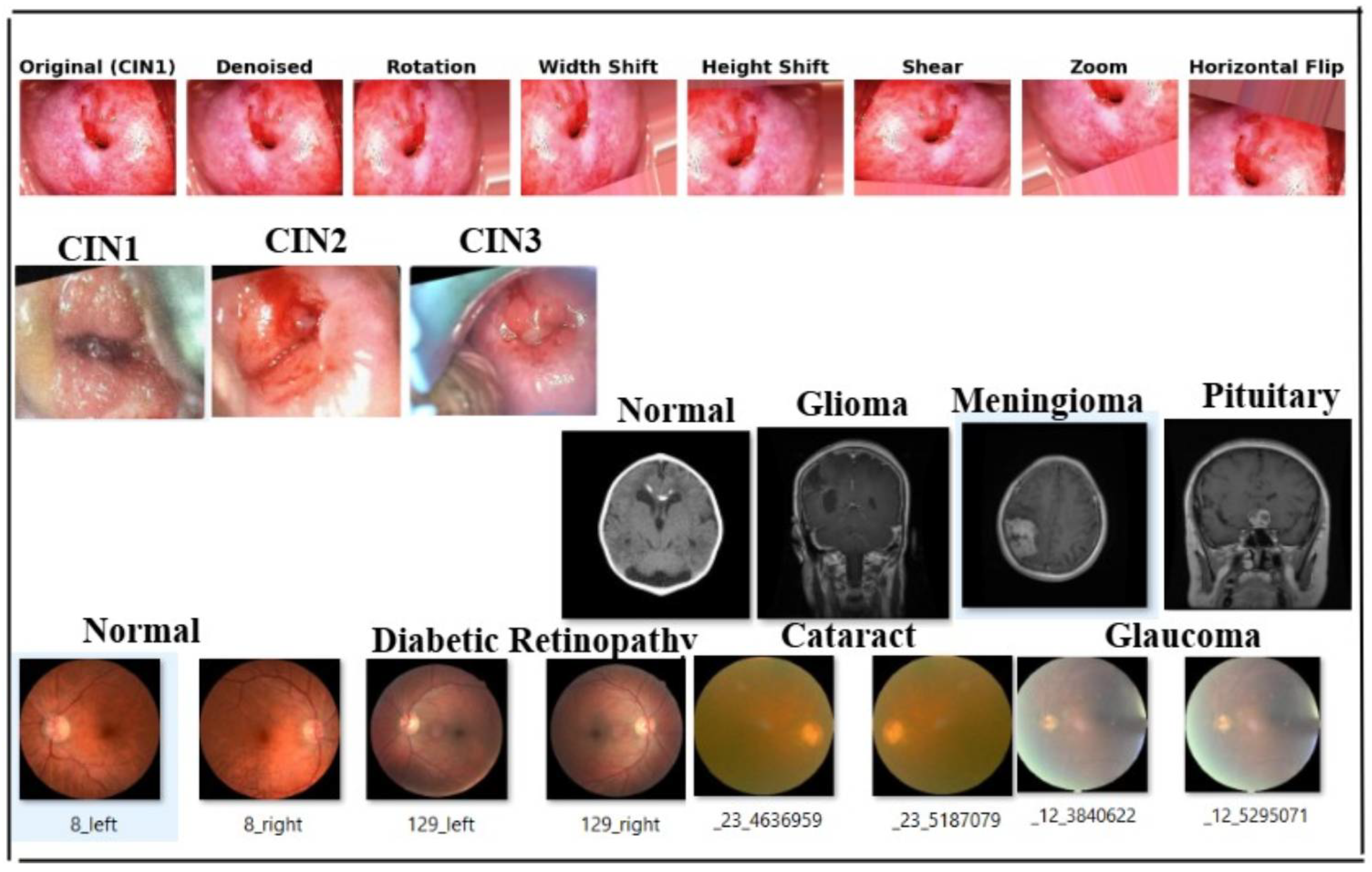 Cancers 17 01521 g003