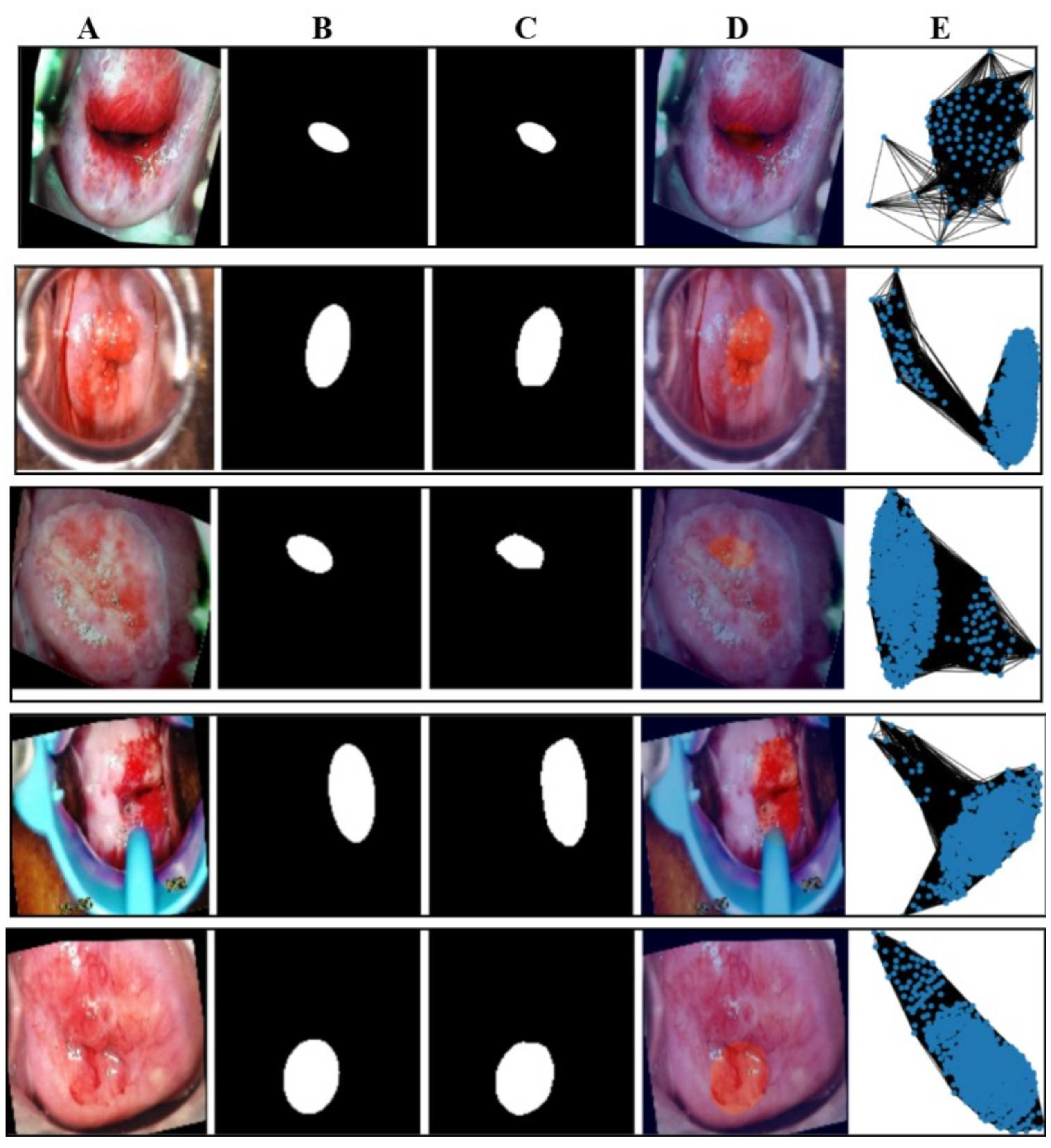 Cancers 17 01521 g006