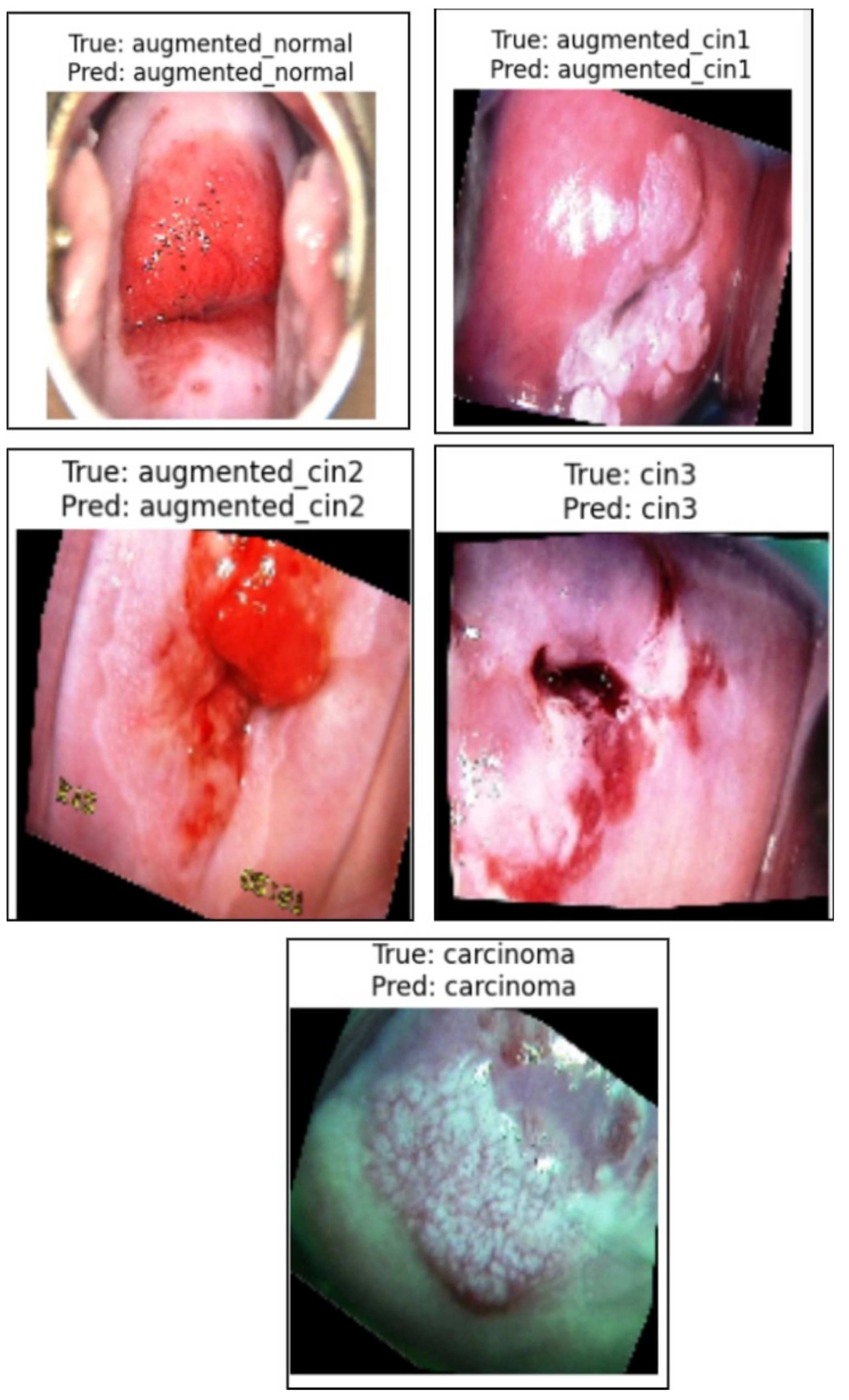 Cancers 17 01521 g007