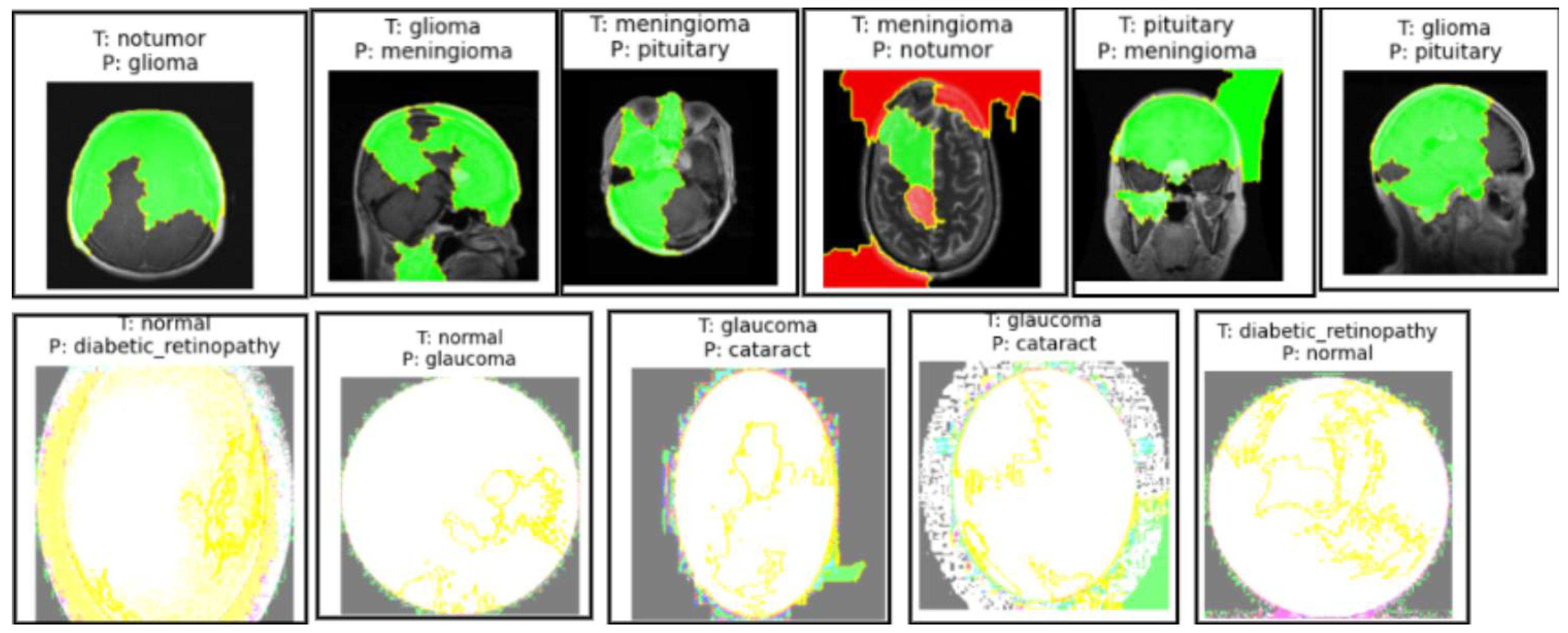 Cancers 17 01521 g011