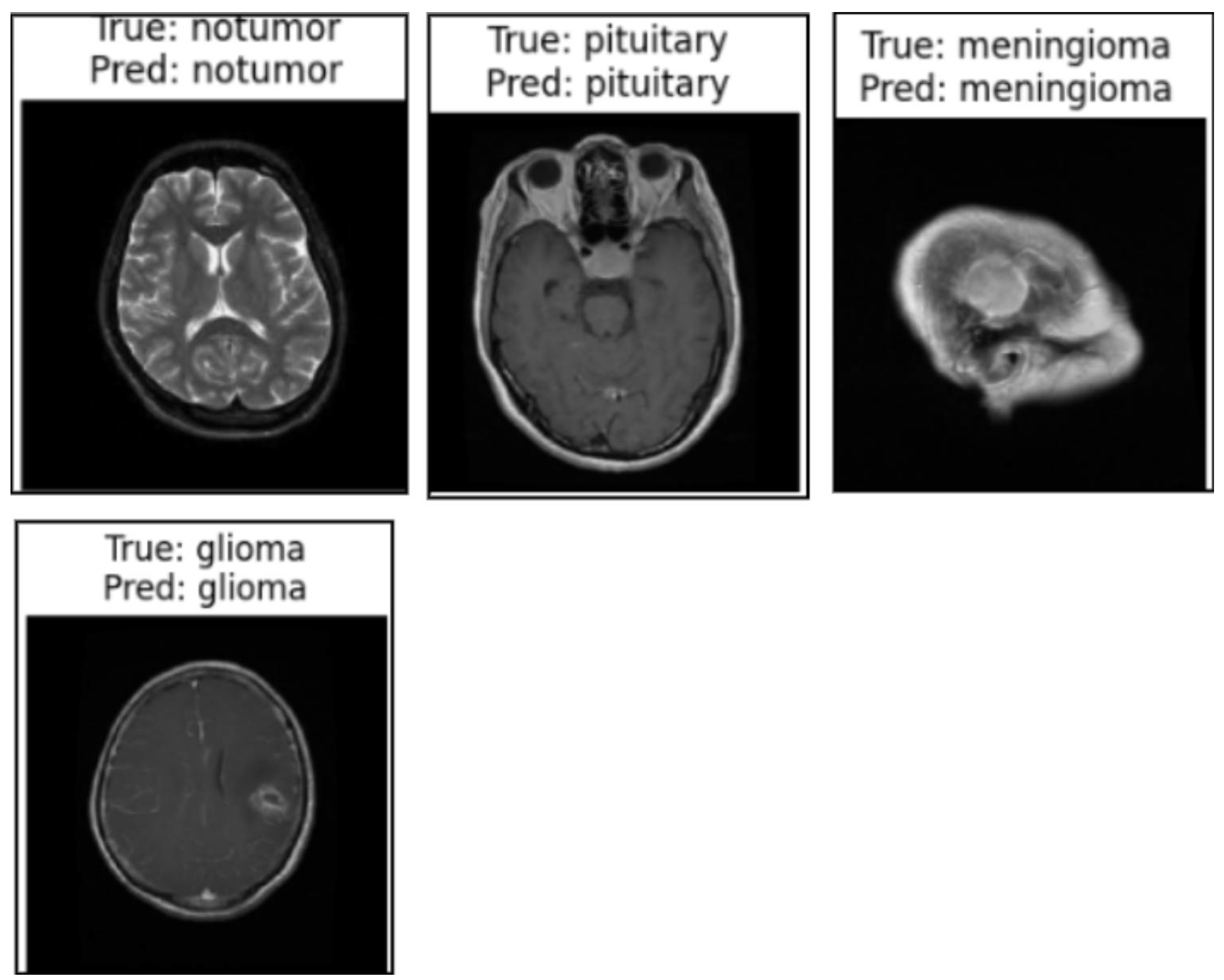 Cancers 17 01521 g012