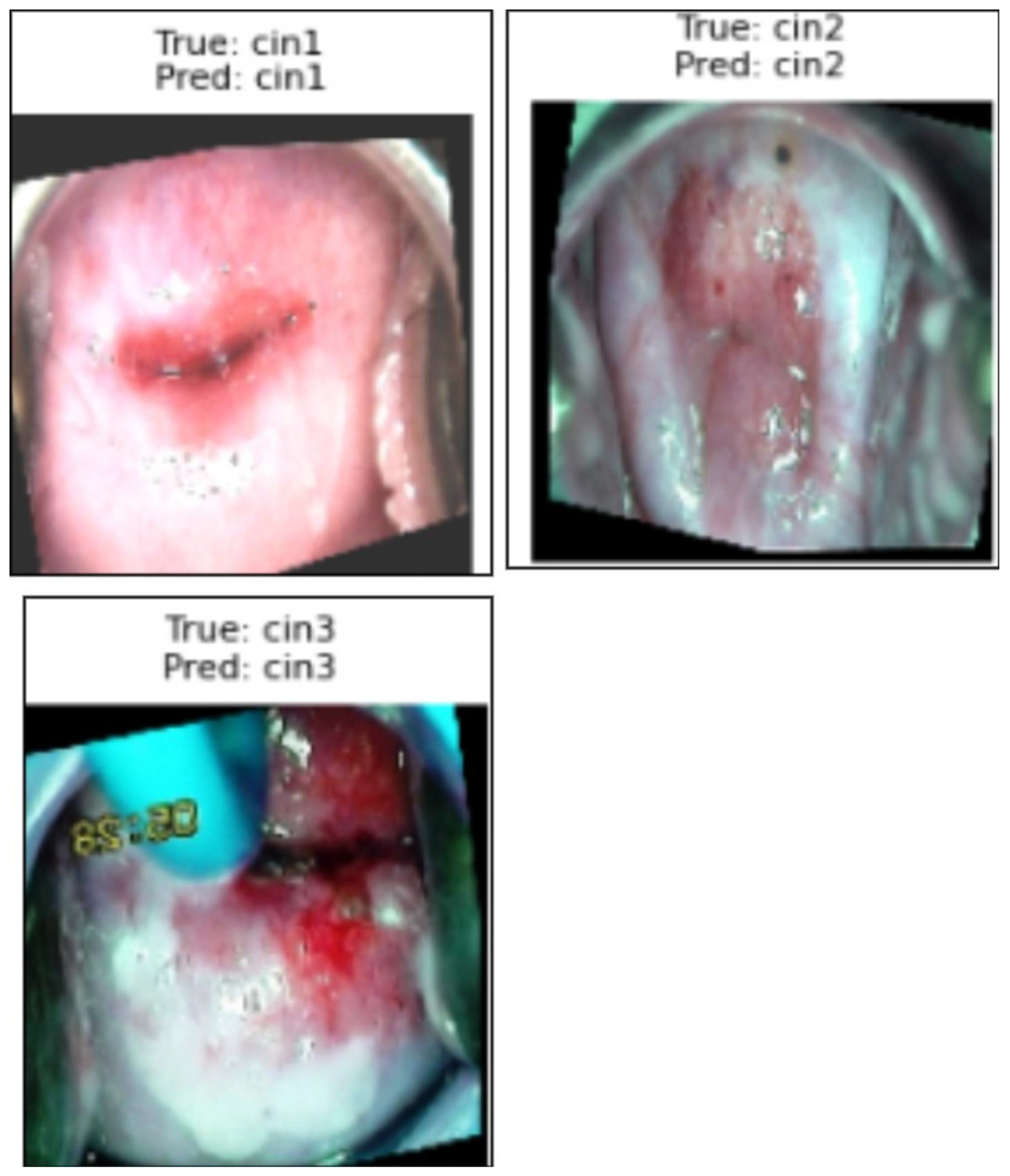 Cancers 17 01521 g013