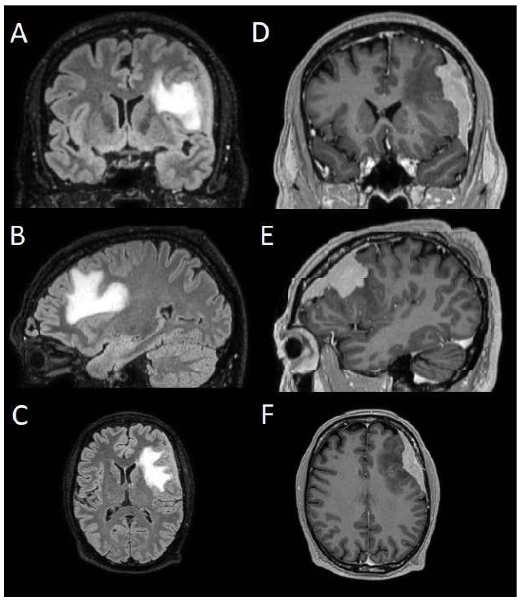 Cancers 17 01523 g001