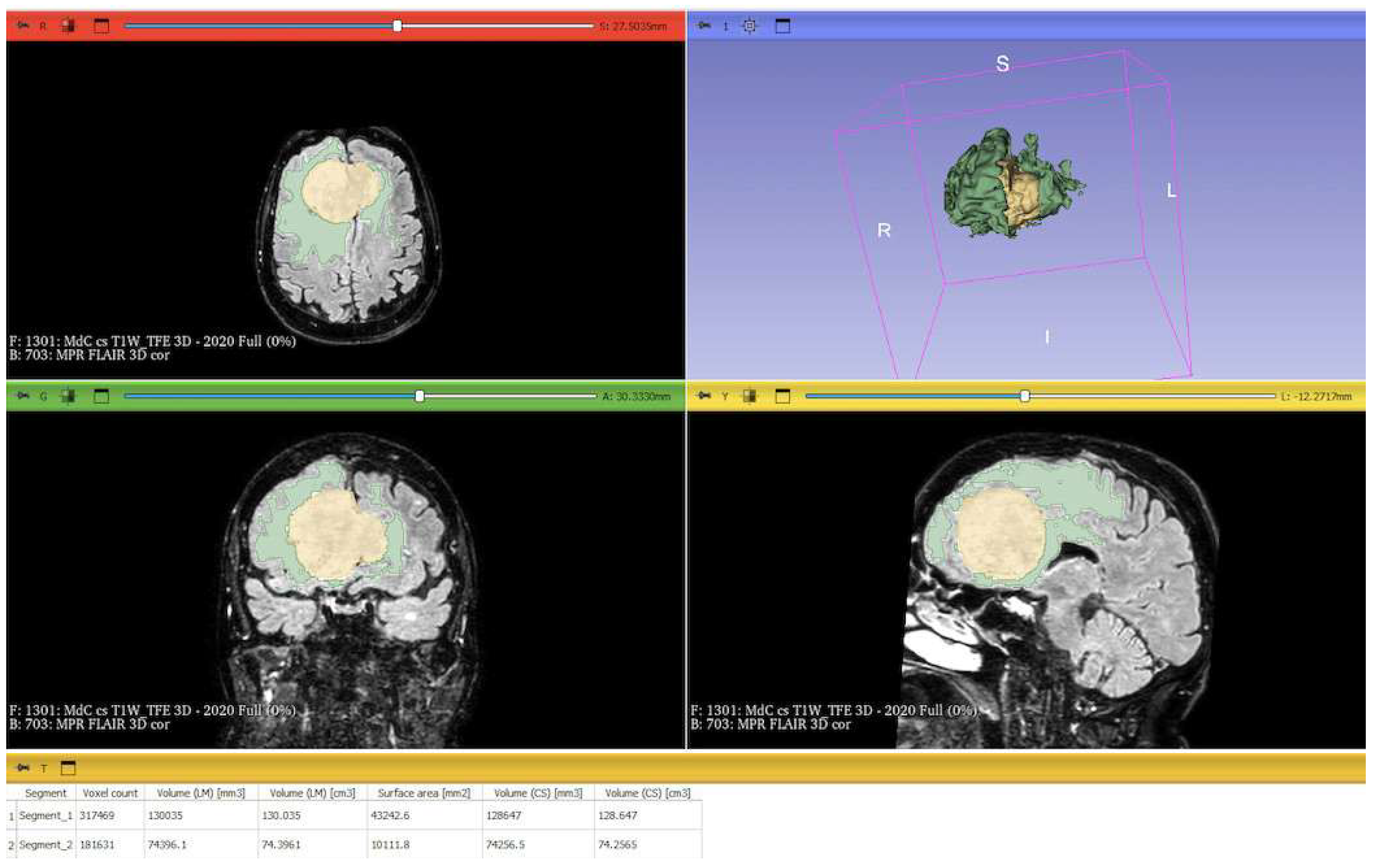 Cancers 17 01523 g003