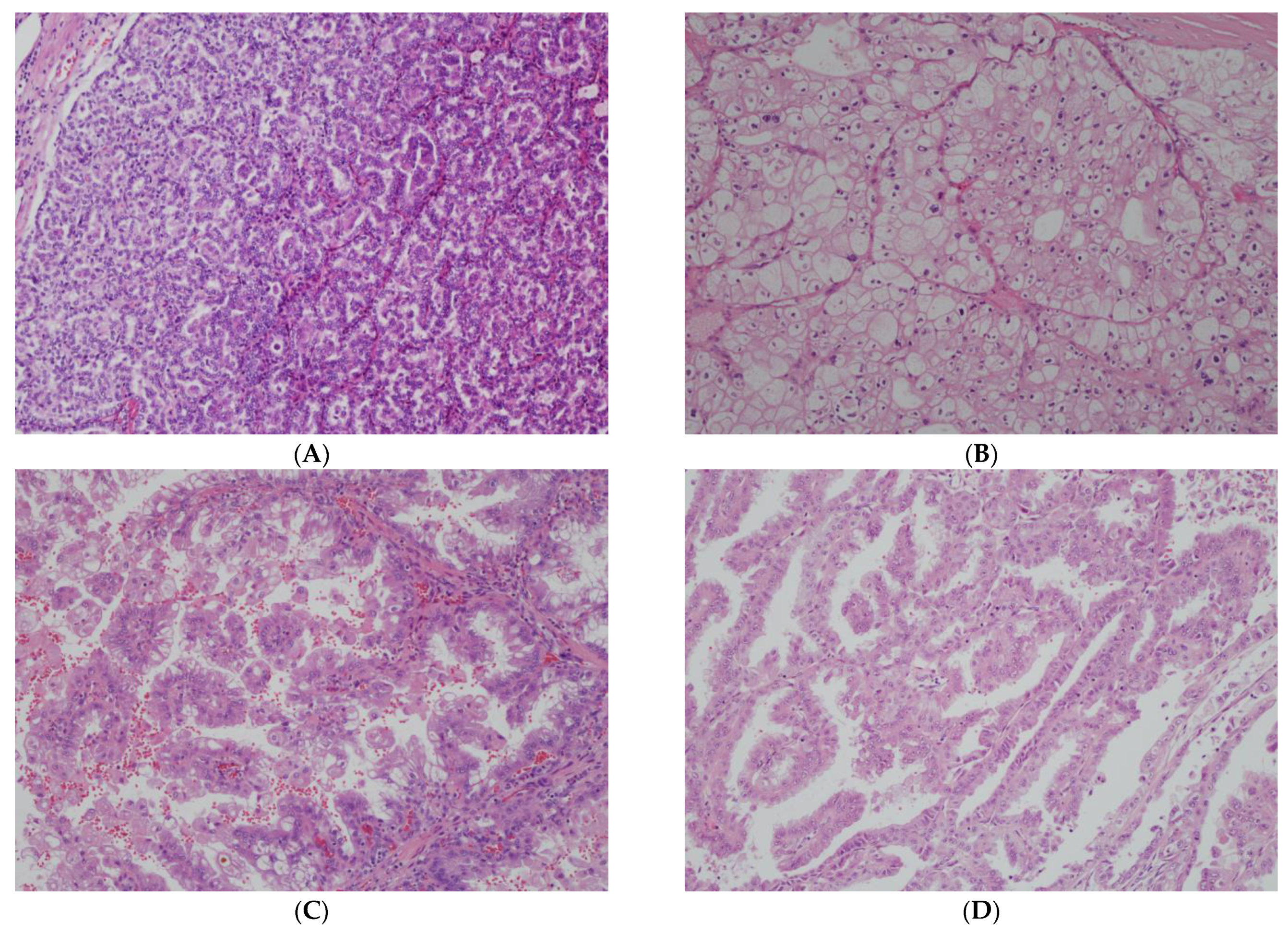 Cancers 17 01527 g001