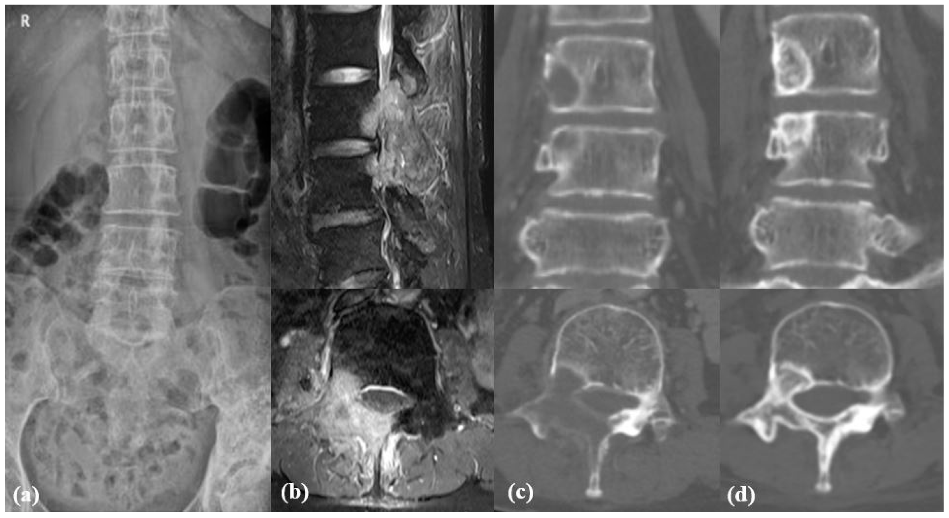 Cancers 17 01539 g003