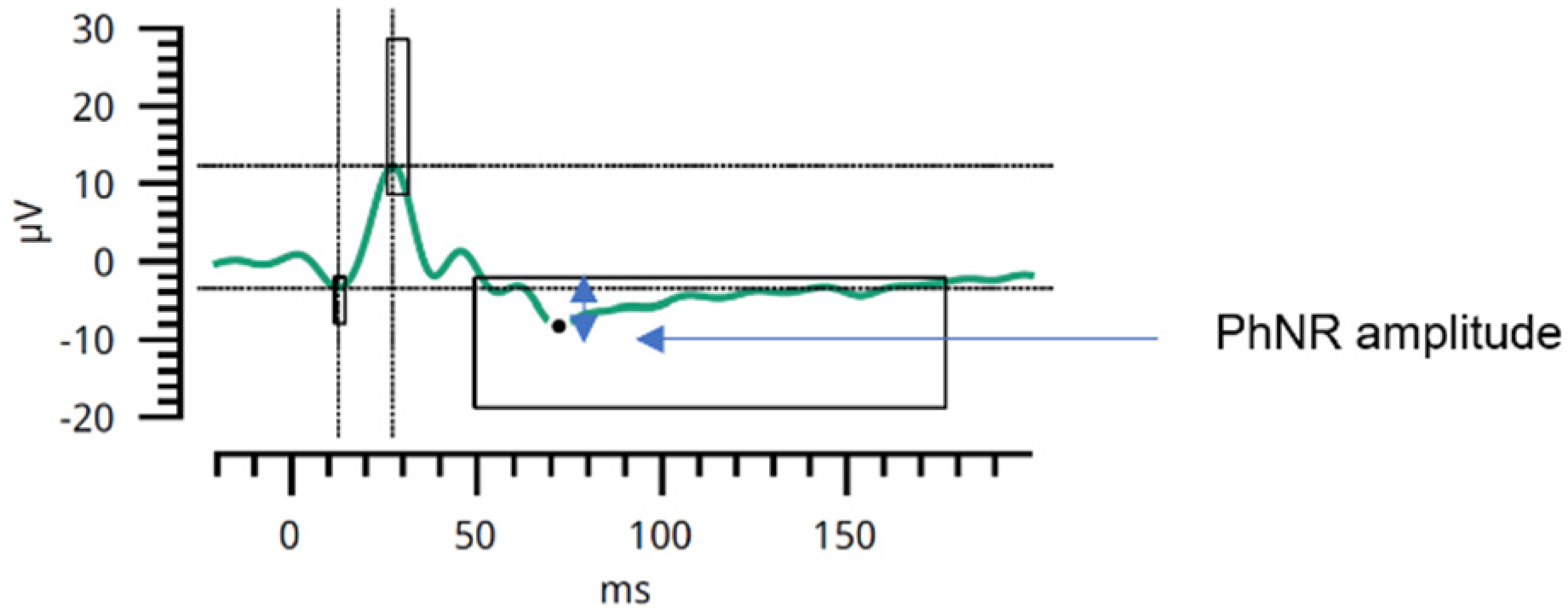 Cancers 17 01542 g002