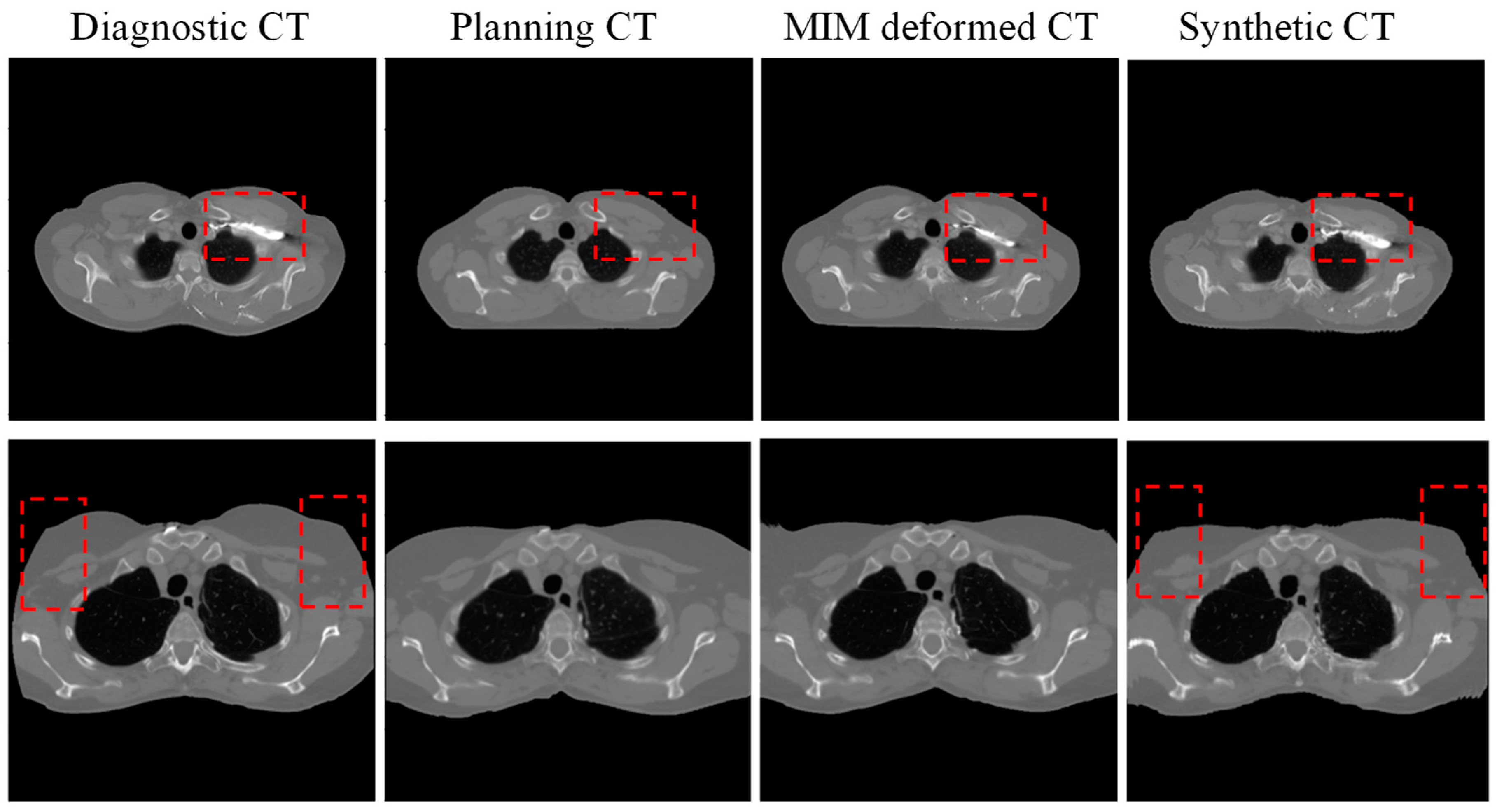 Cancers 17 01553 g004