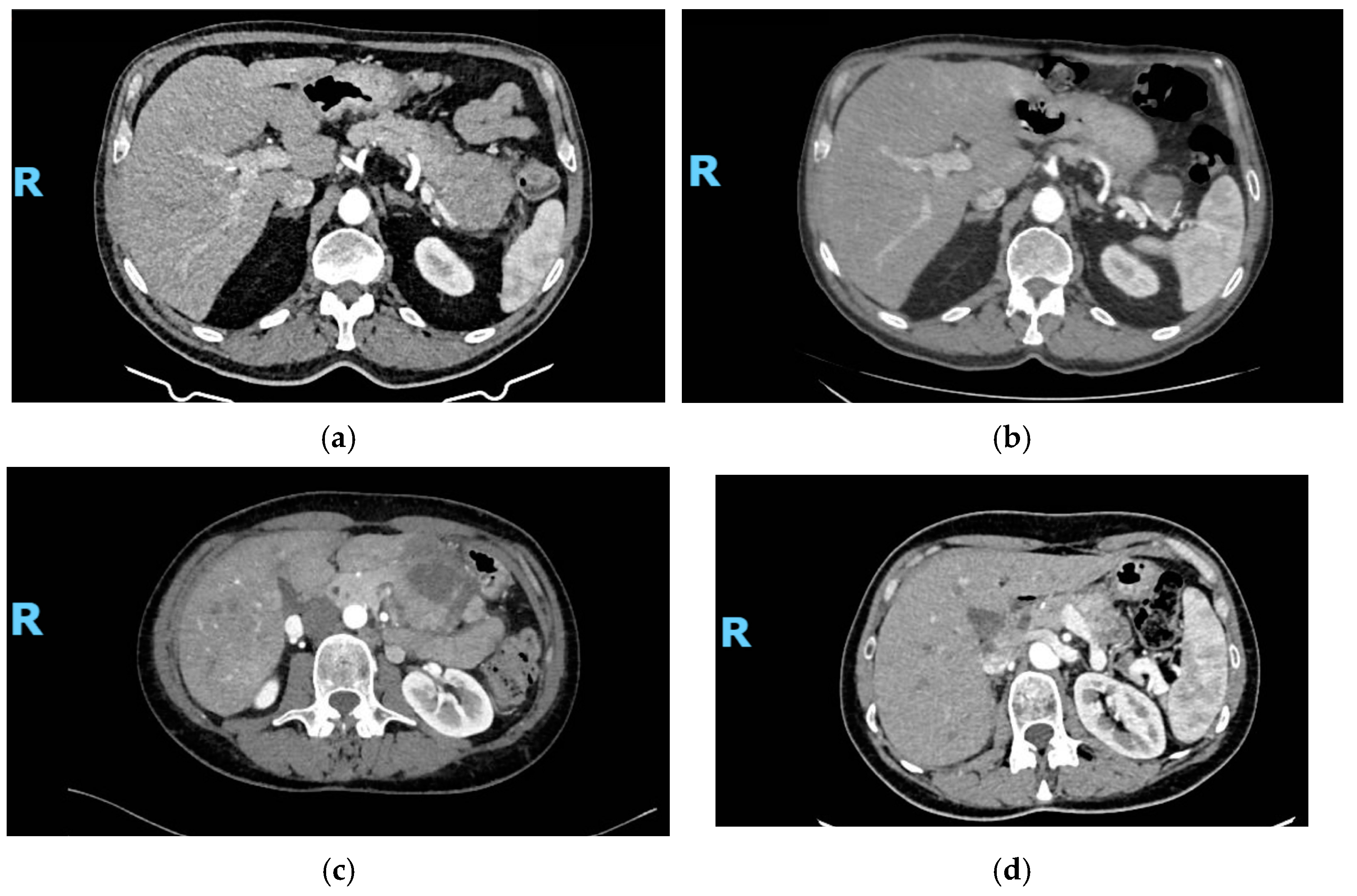 Cancers 17 01561 g002