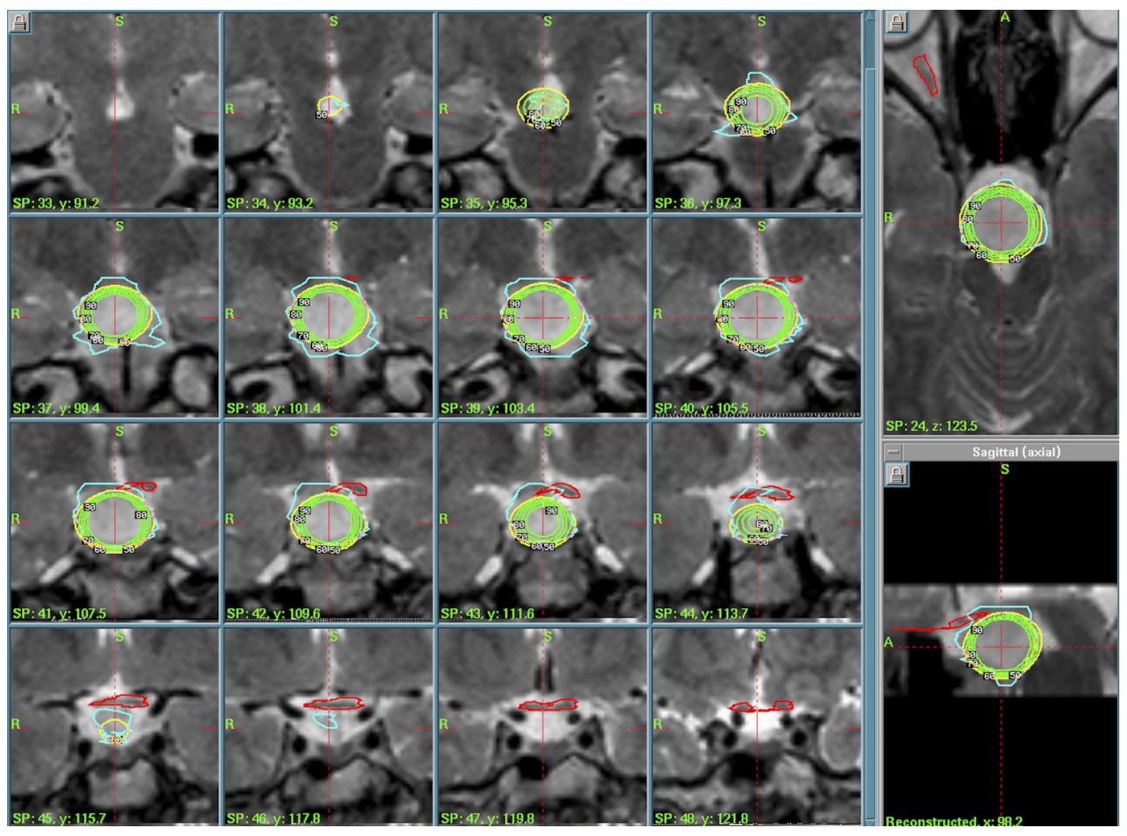 Cancers 17 01564 g001
