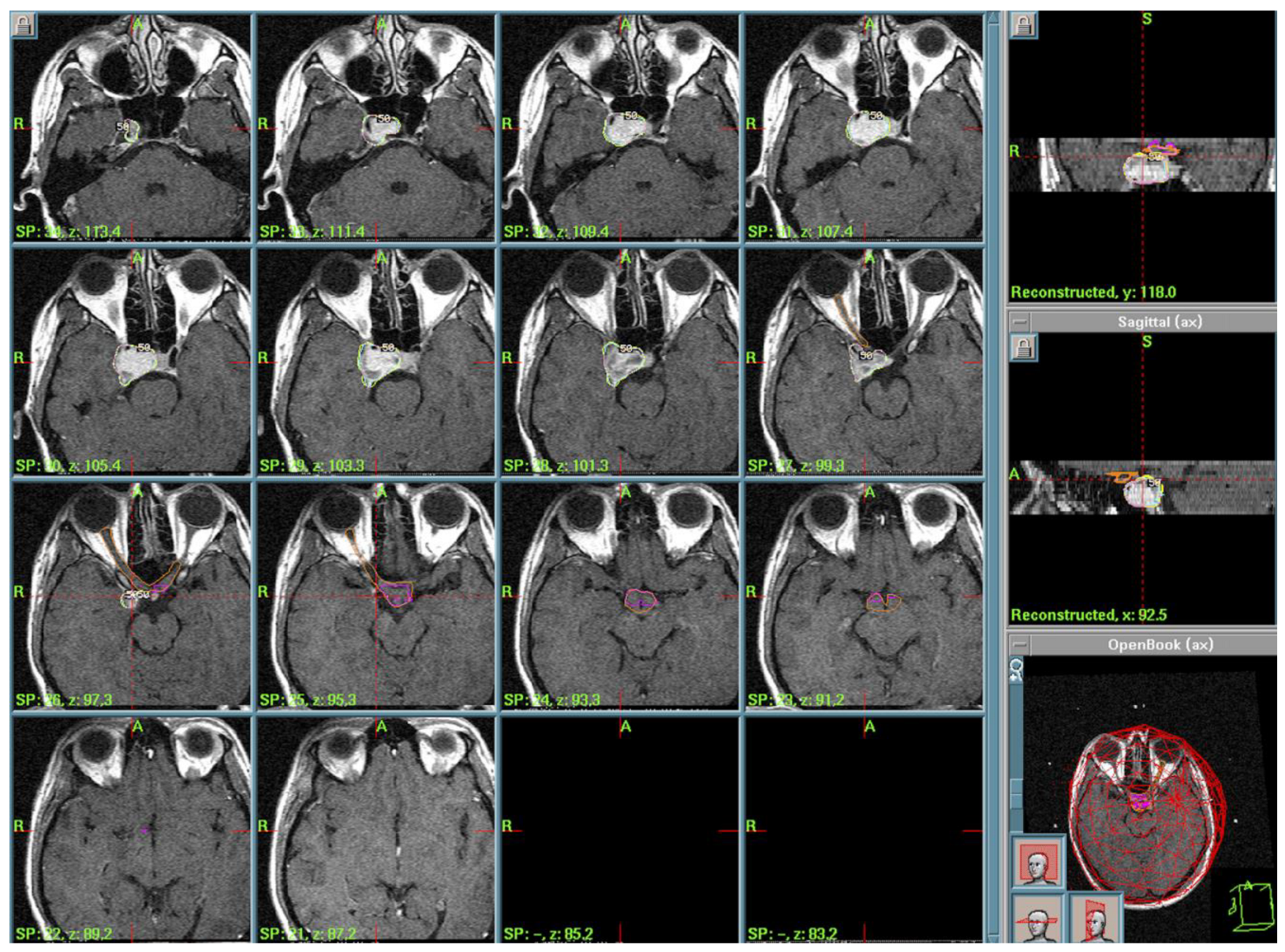 Cancers 17 01564 g002