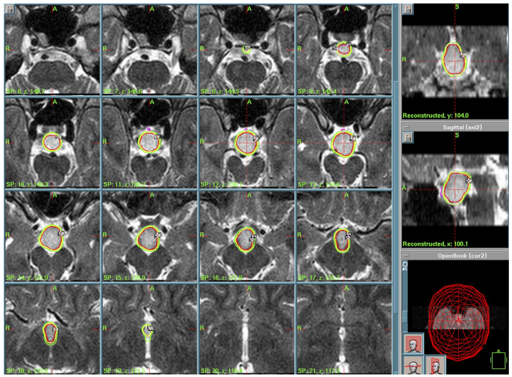 Cancers 17 01564 g003