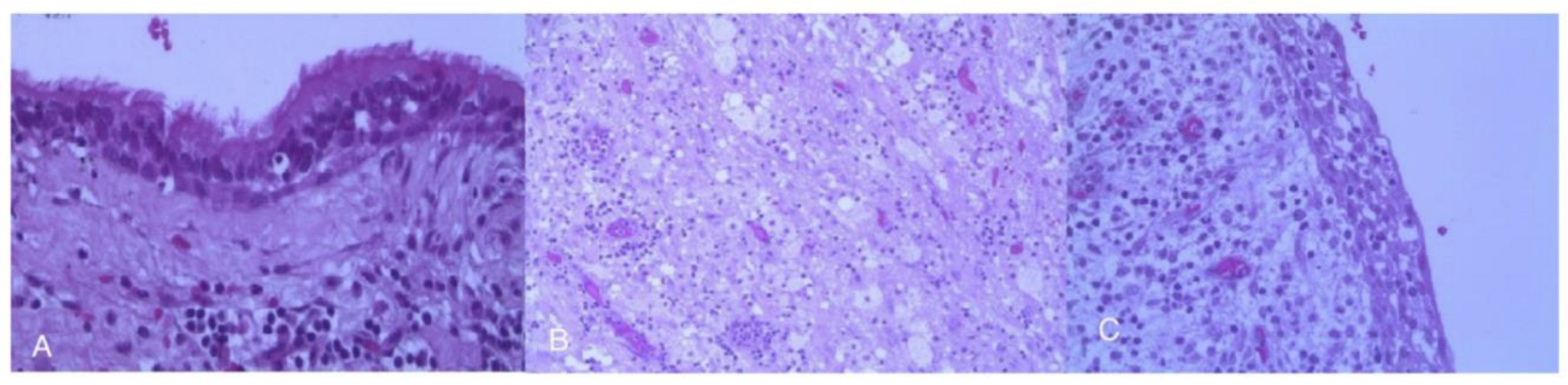 Cancers 17 01564 g005