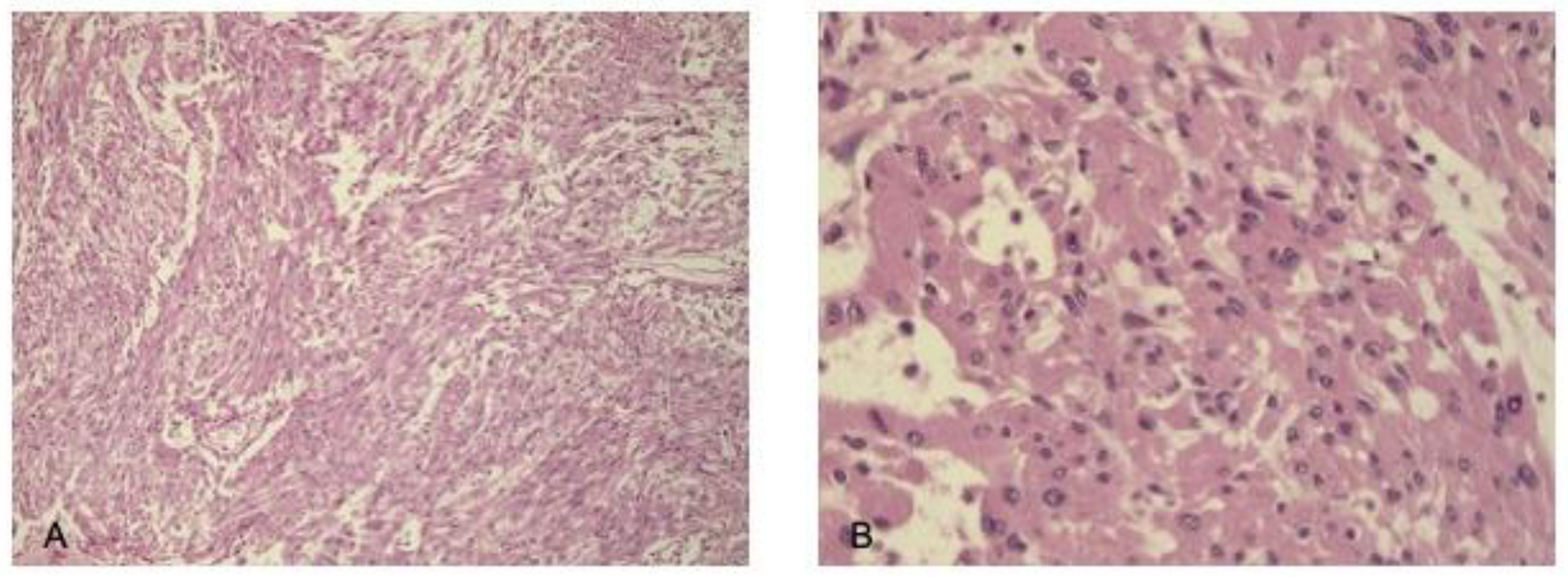 Cancers 17 01564 g008