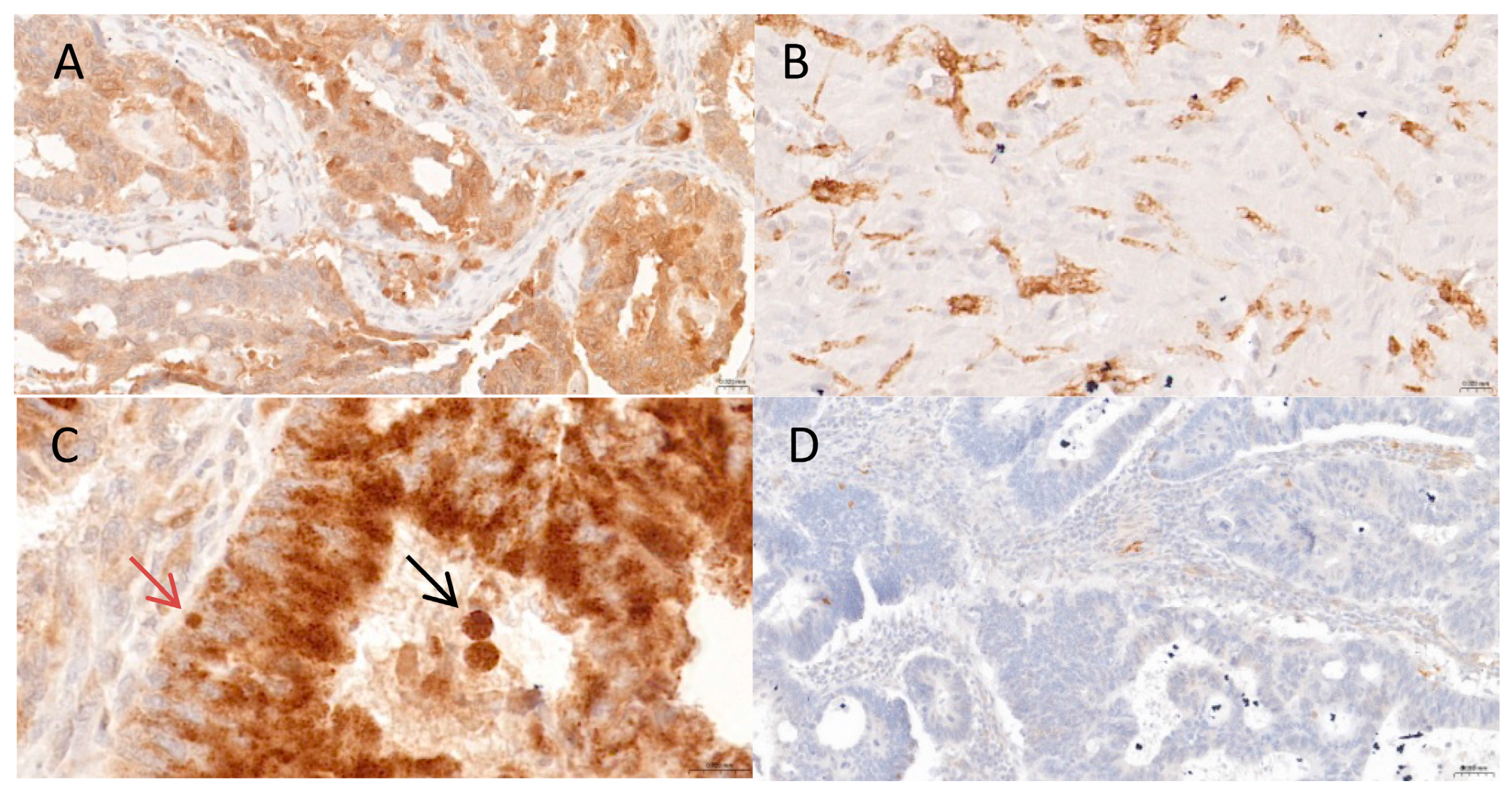 Cancers 17 01568 g001