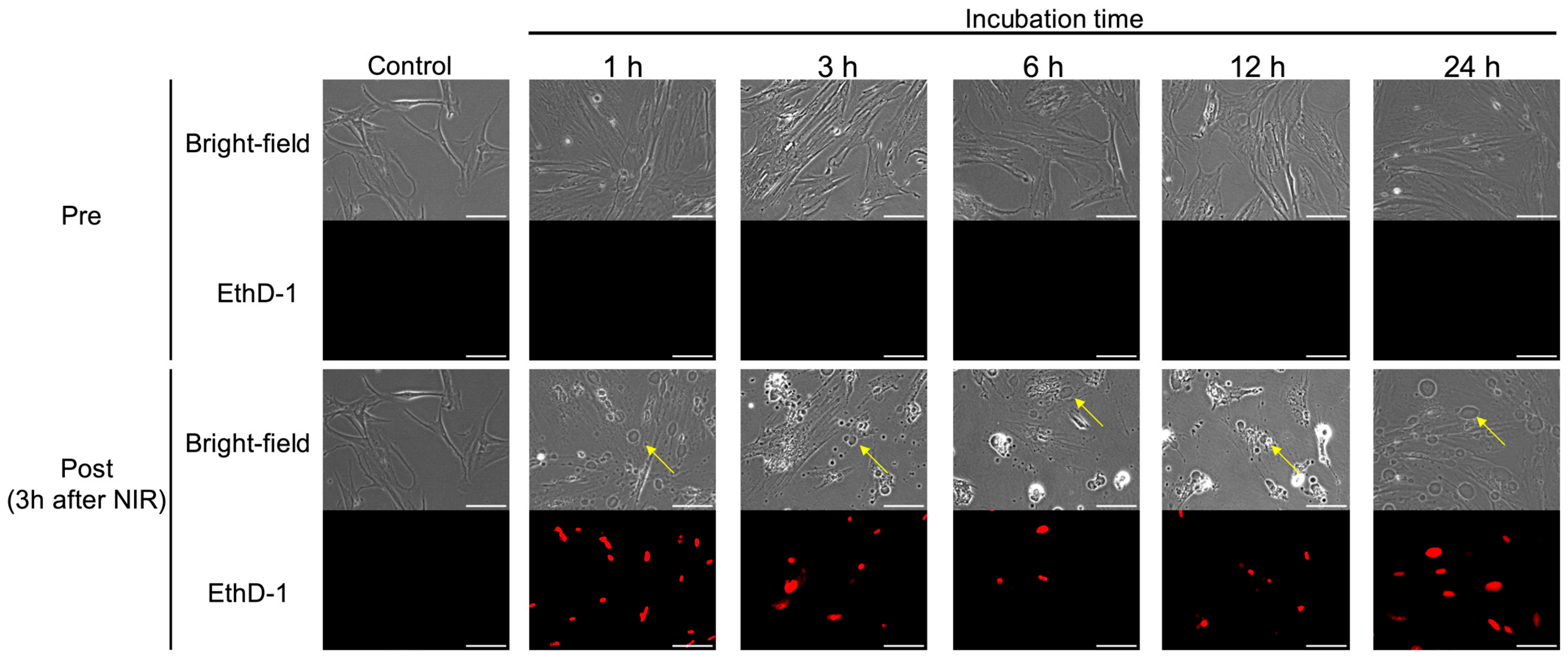 Cancers 17 01584 g003
