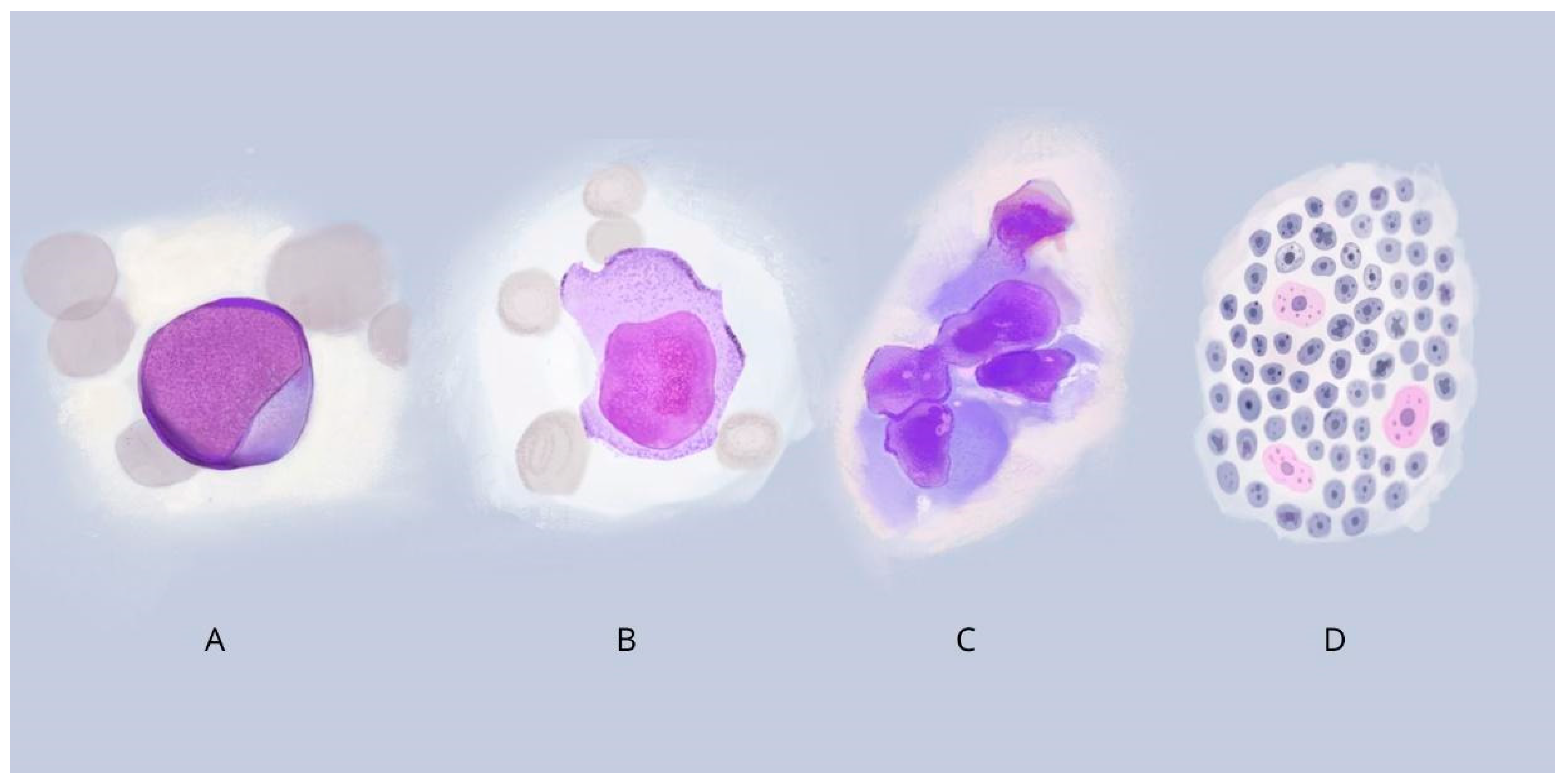 Cancers 17 01590 g002