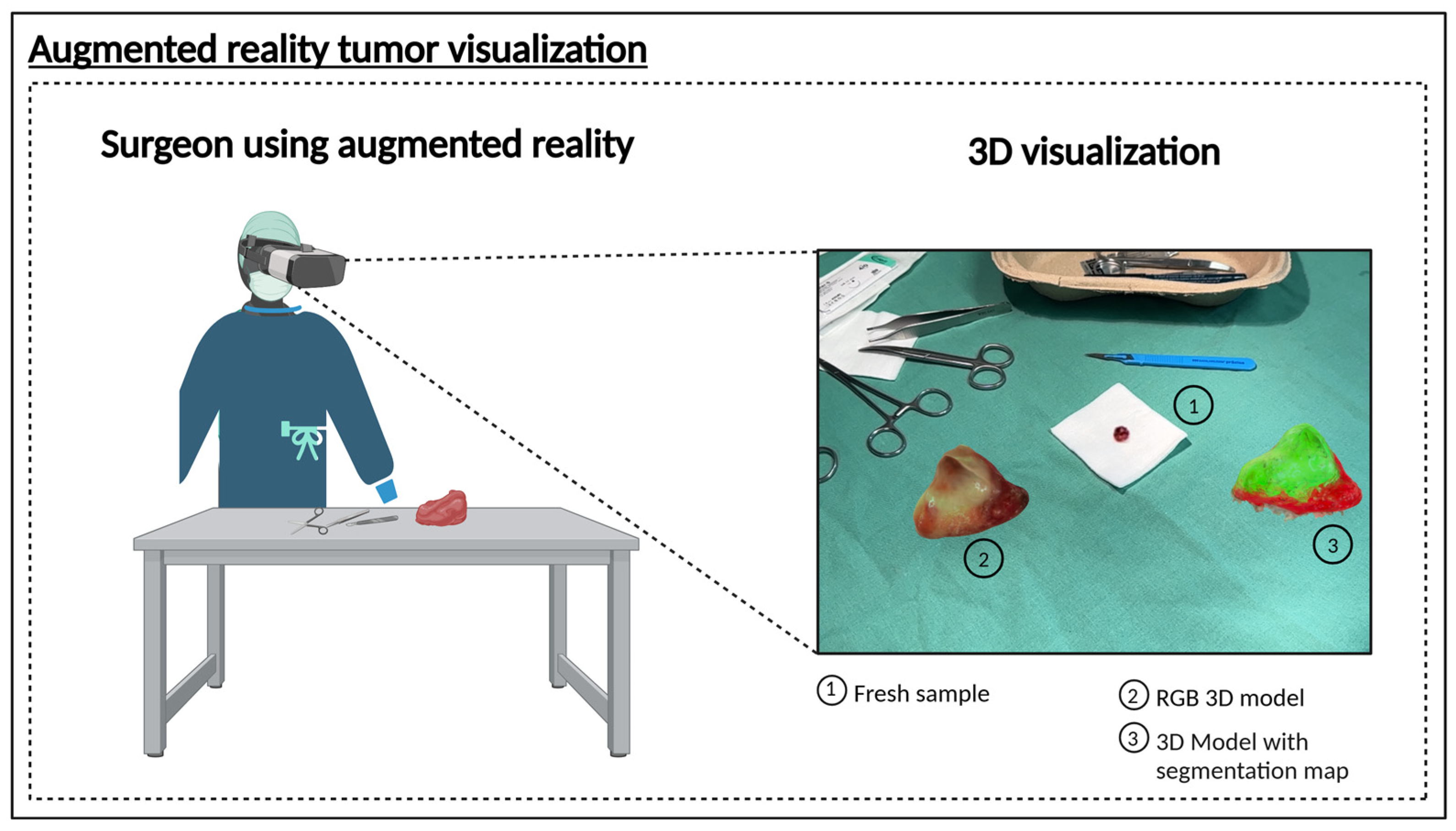 Cancers 17 01617 g004