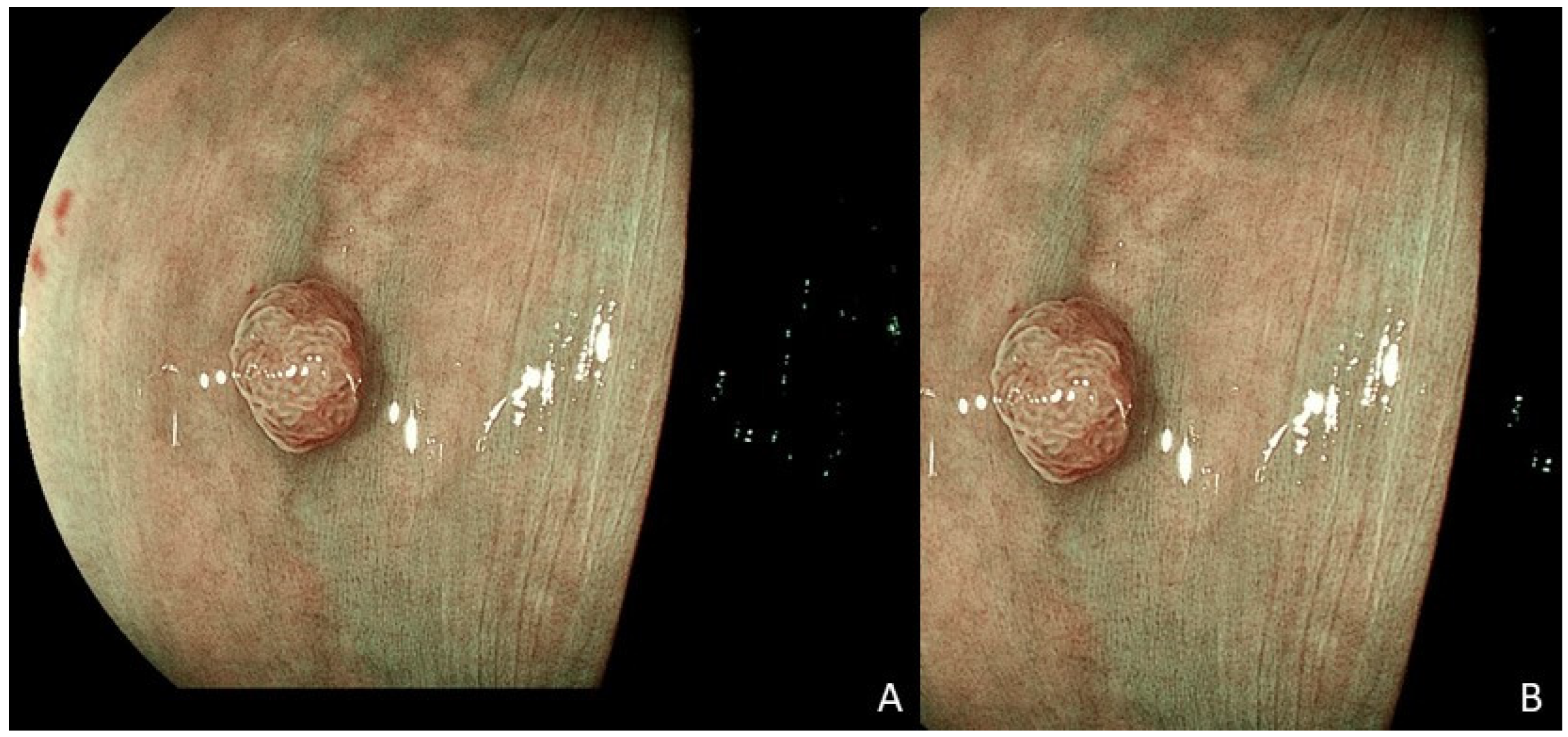 Cancers 17 01620 g002