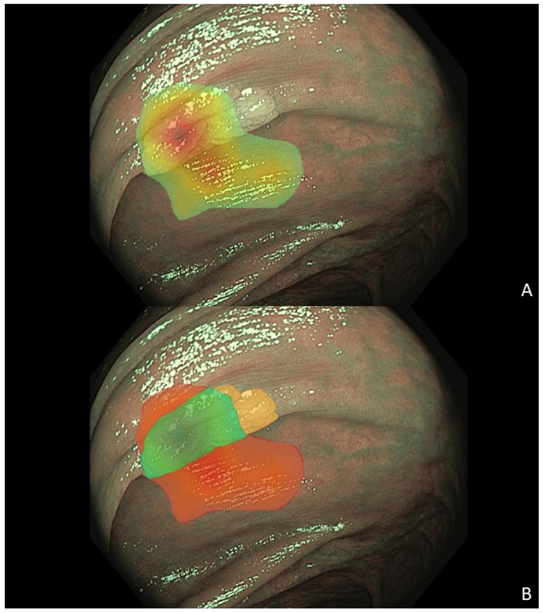 Cancers 17 01620 g003