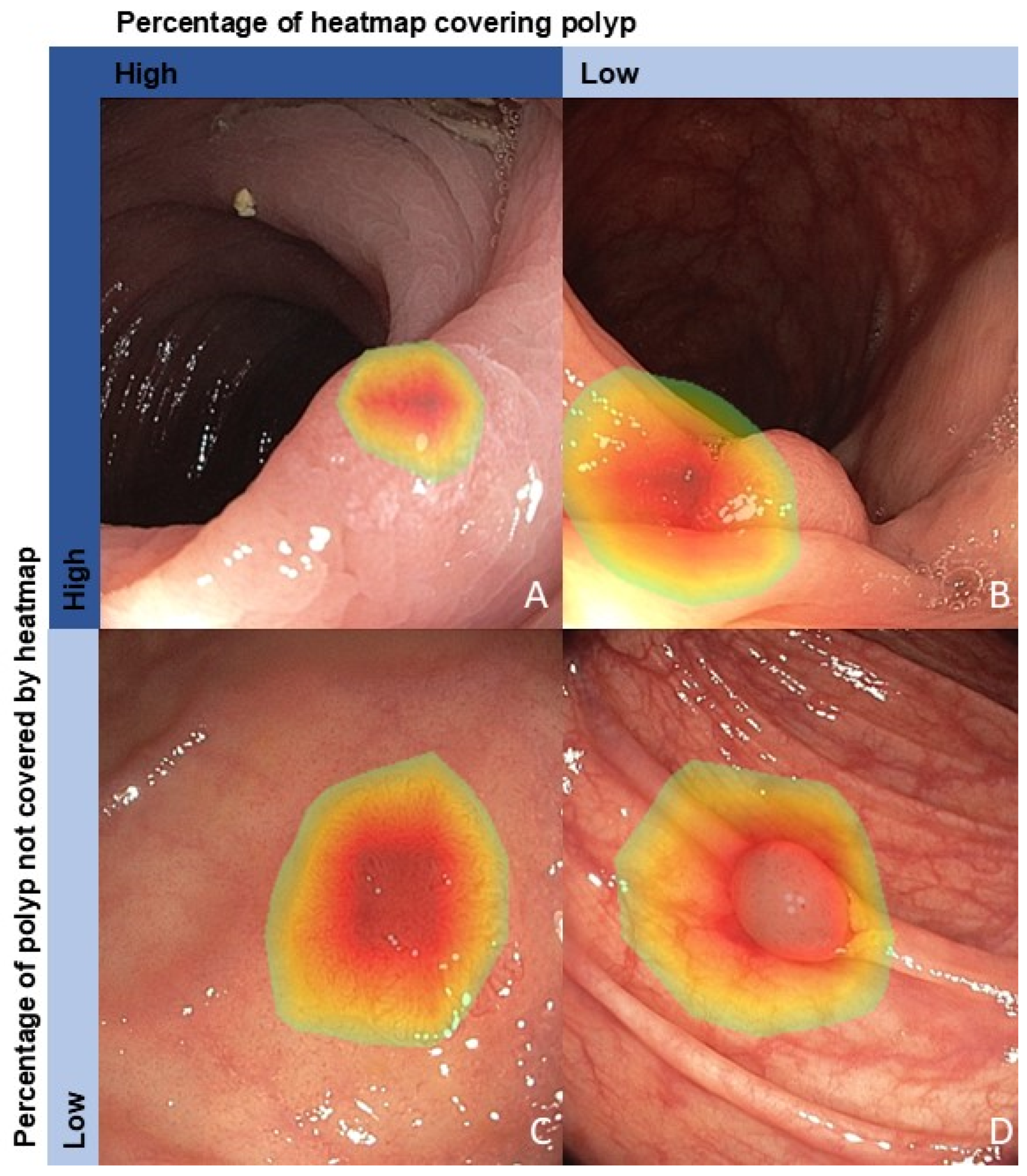 Cancers 17 01620 g004