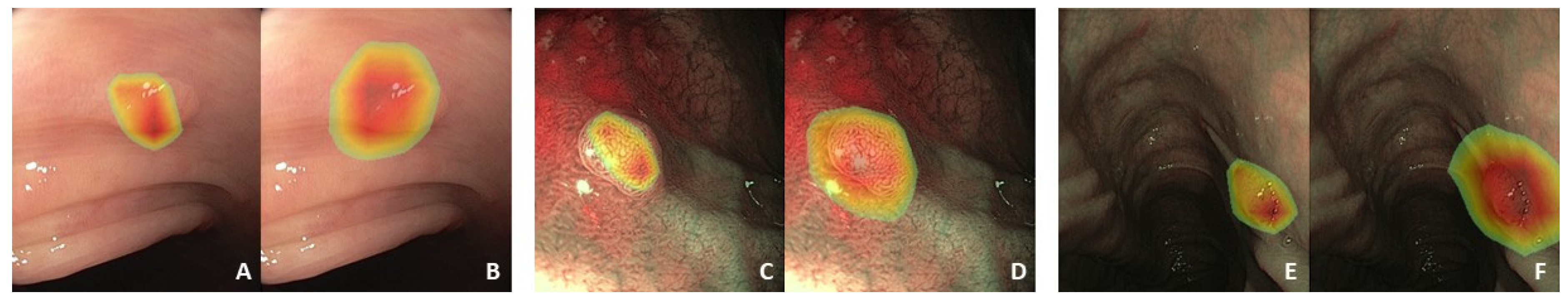 Cancers 17 01620 g0a1
