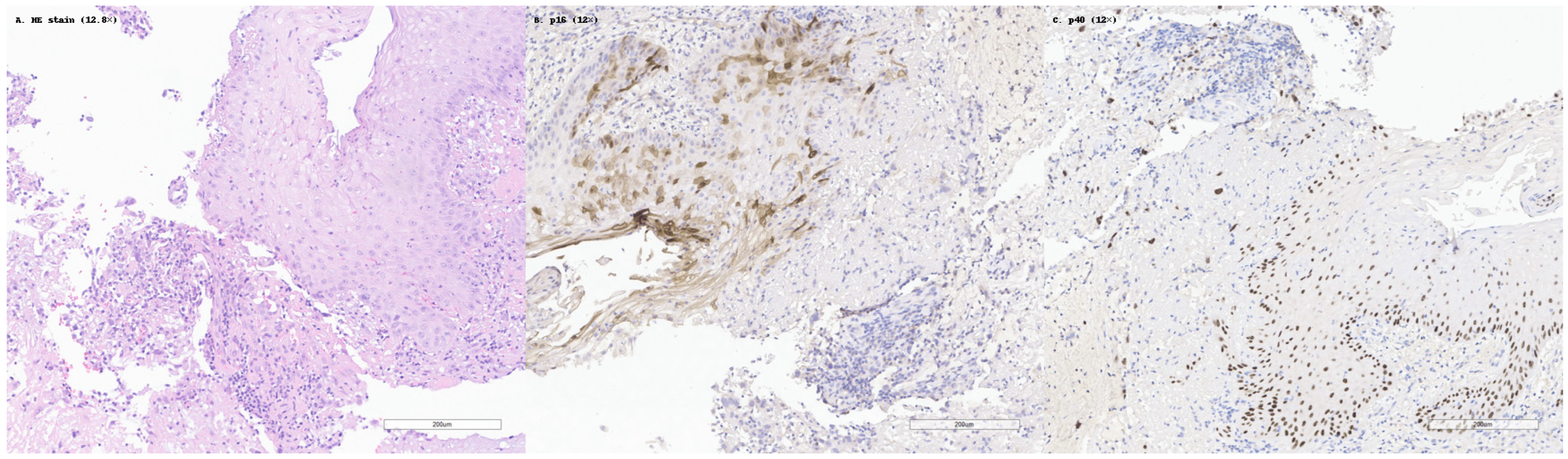 Cancers 17 01629 g002