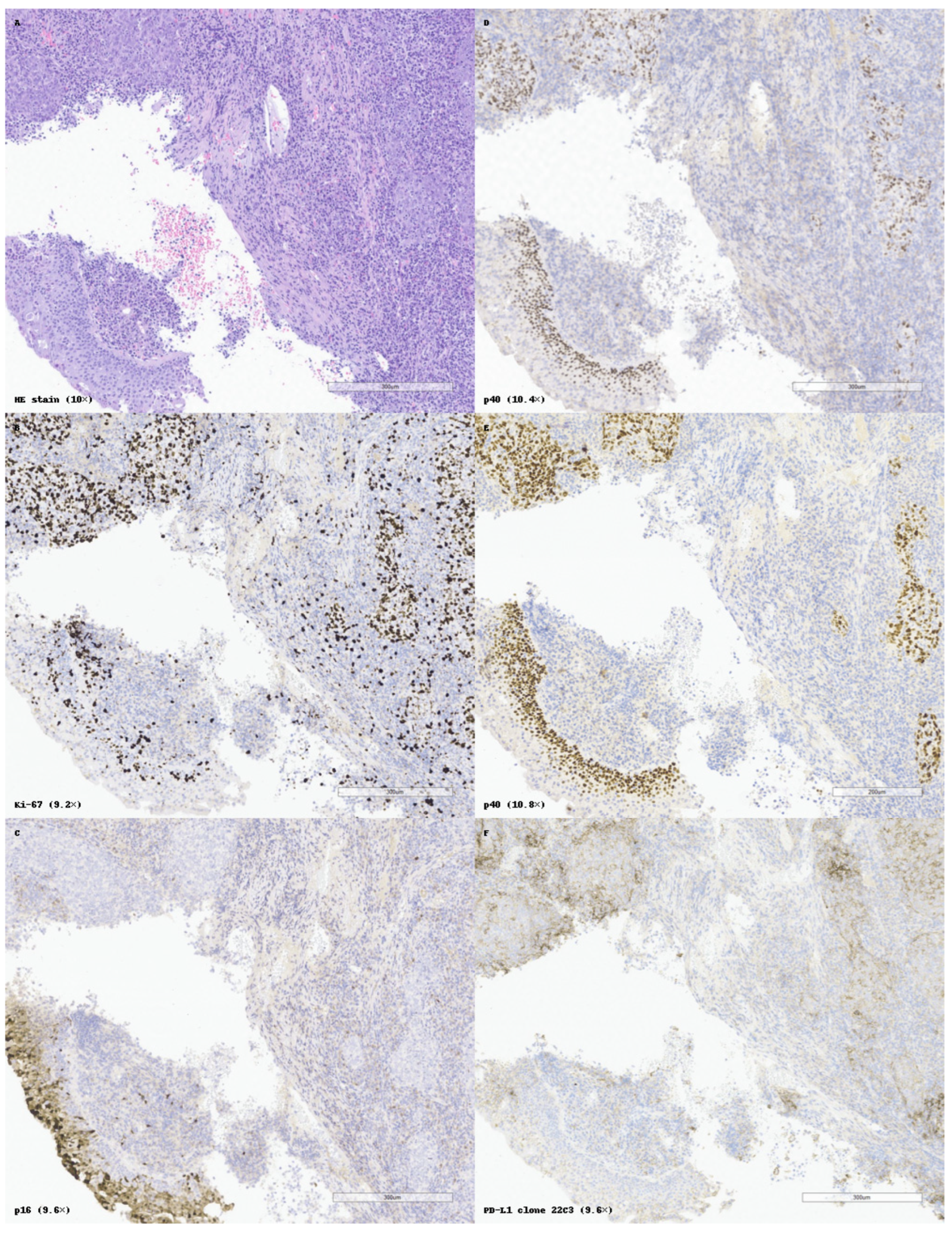 Cancers 17 01629 g004