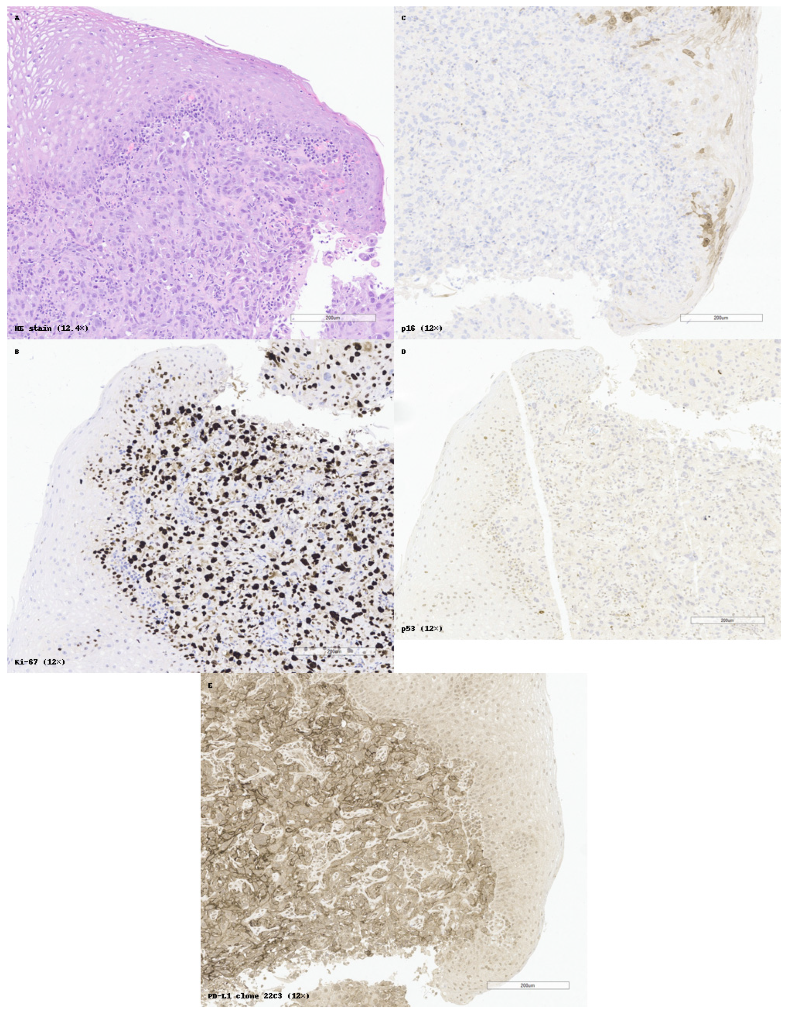 健康・医学 Diagnostic Immunohistochemistry Diagnostic Immunohistochemistry: Theranostic and Genomic