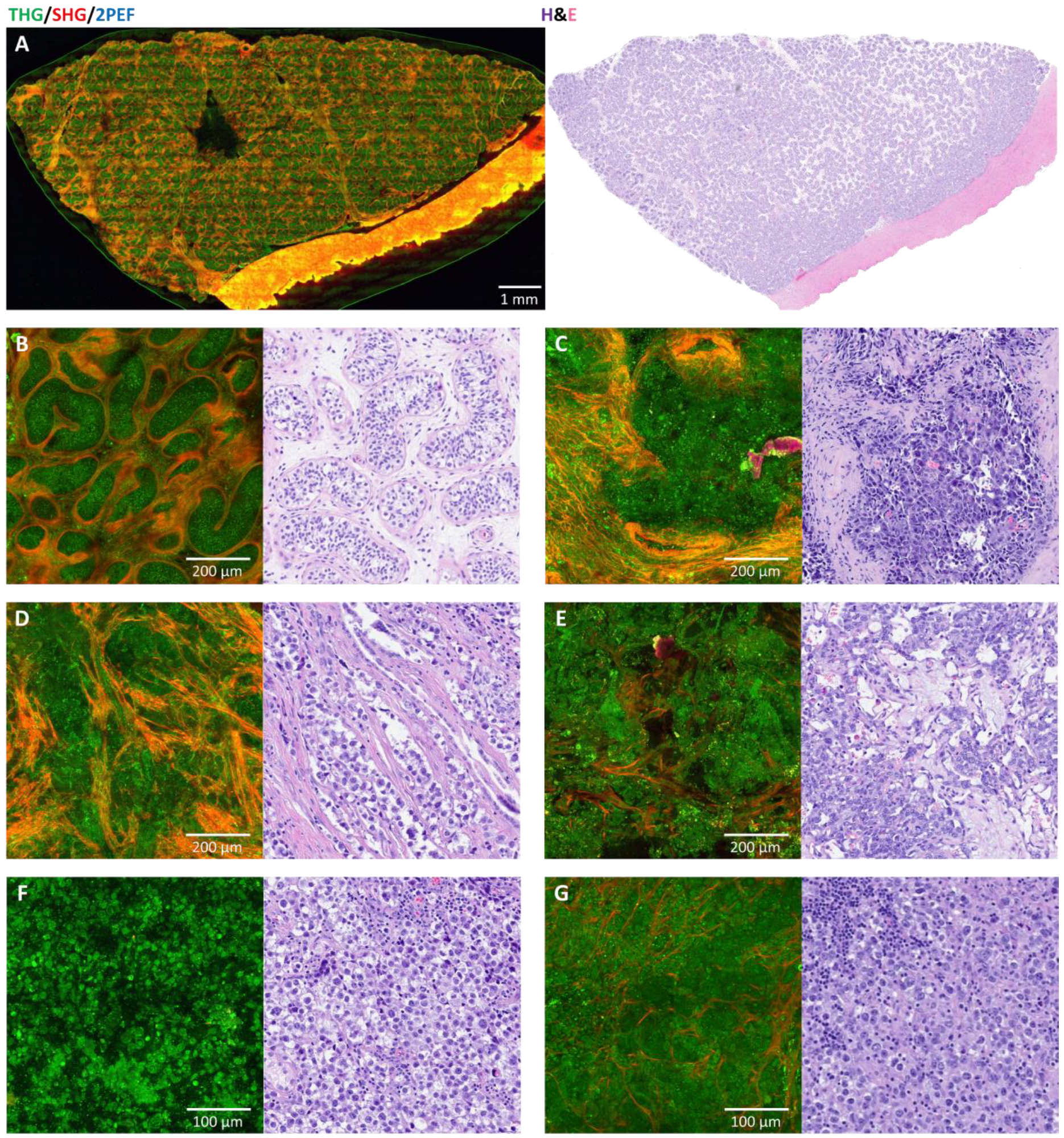 Cancers 17 01636 g002