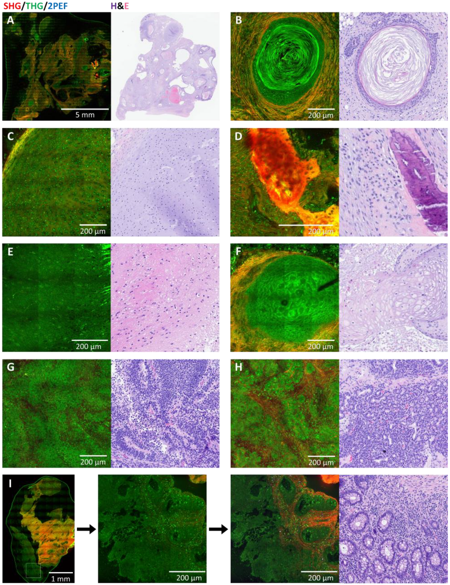 Cancers 17 01636 g003