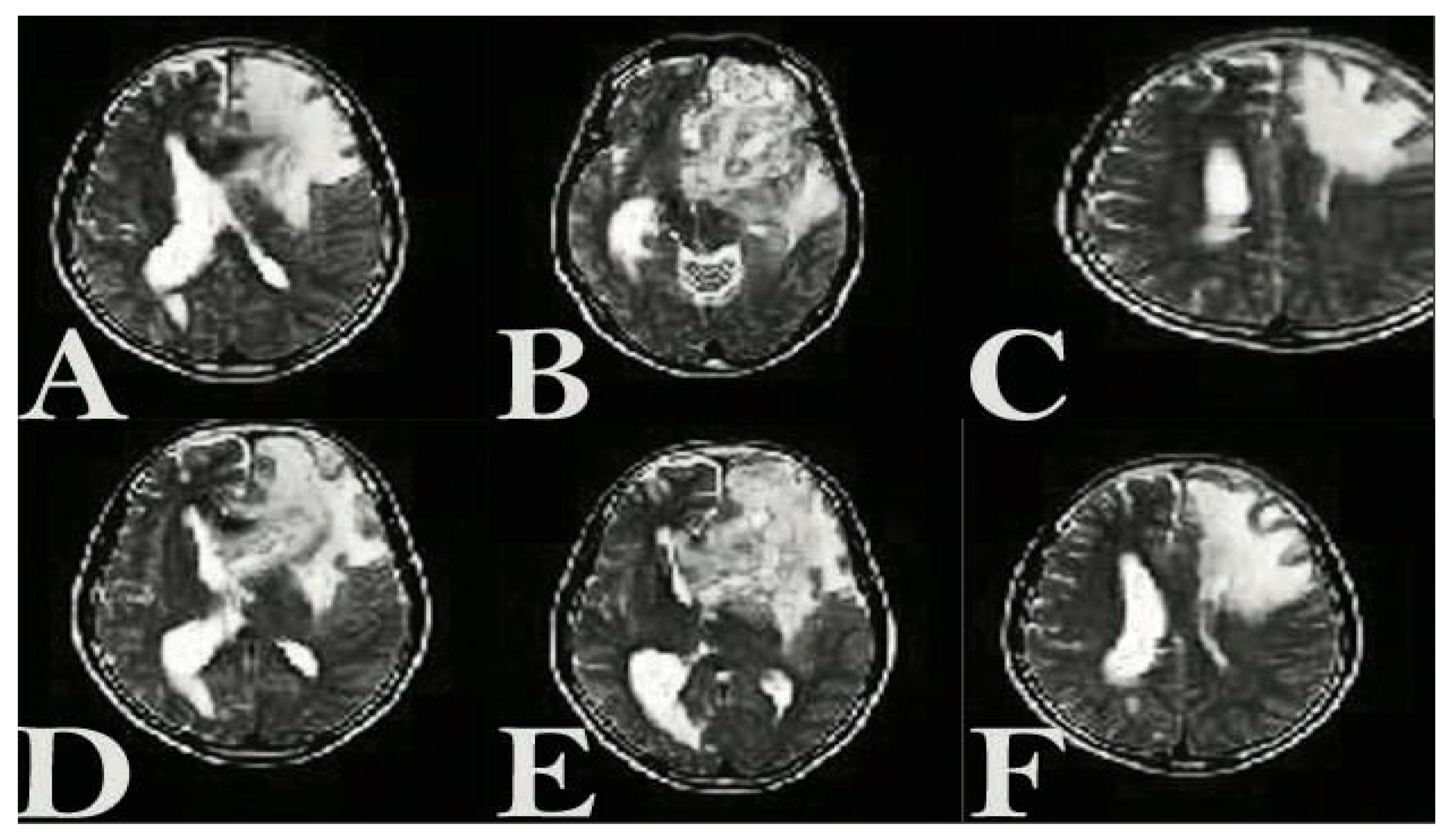 Cancers 17 01648 g008