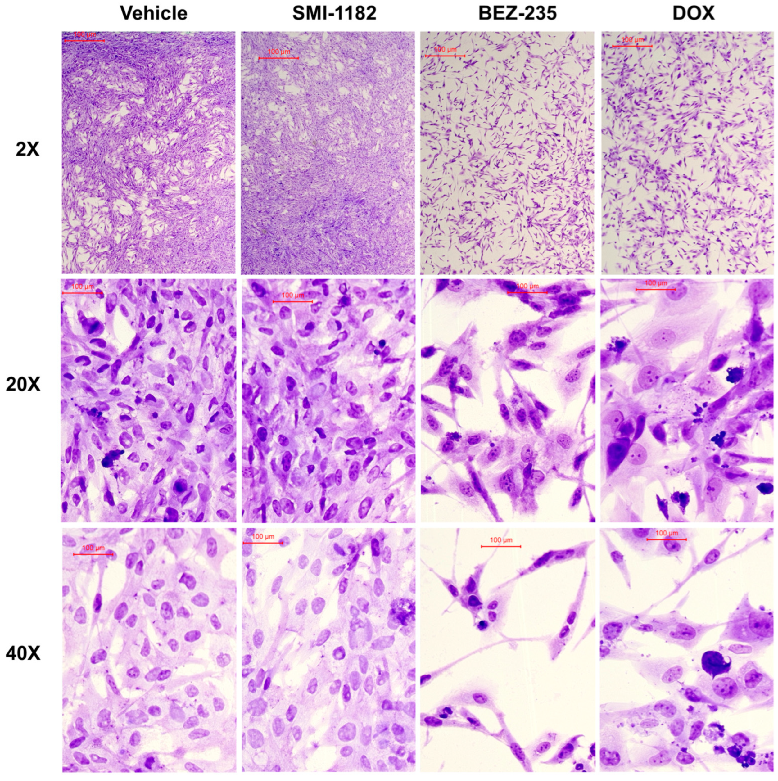 Cancers 17 01671 g008