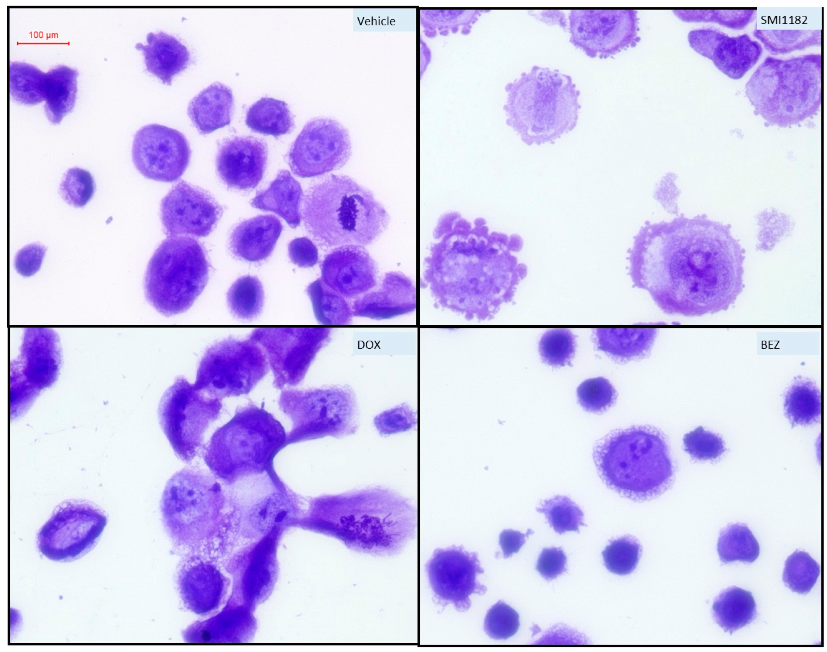 Cancers 17 01671 g009