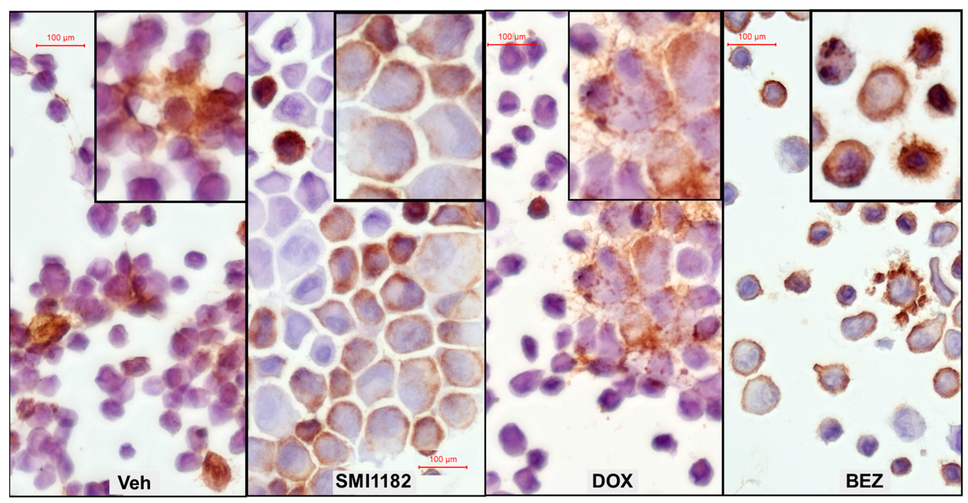 Cancers 17 01671 g011