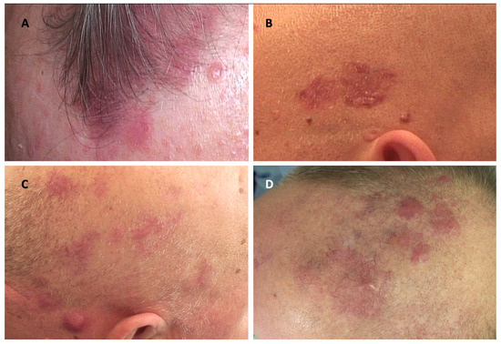 Exploring Neutrophil Heterogeneity and Plasticity in Health