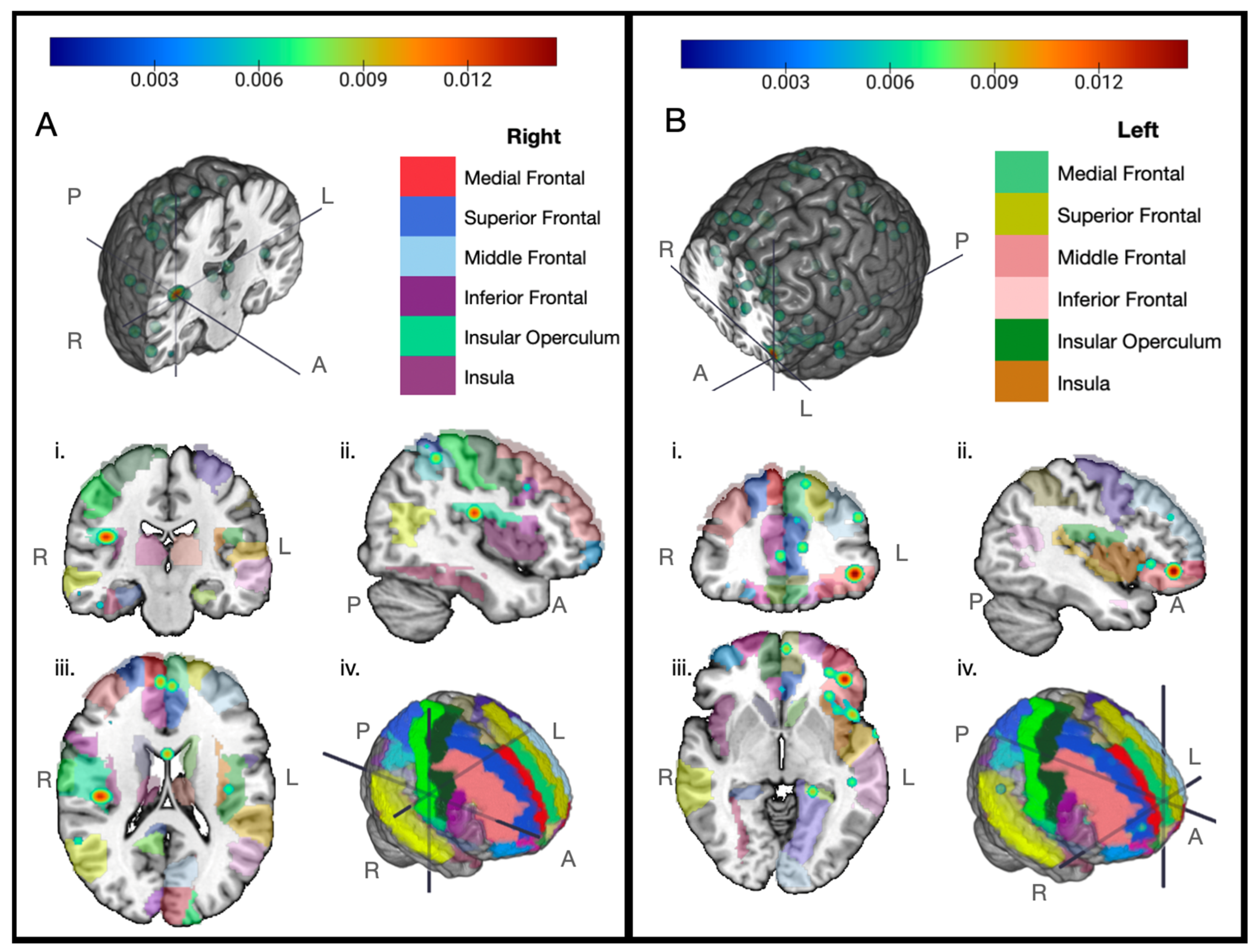 Cancers 17 01684 g002