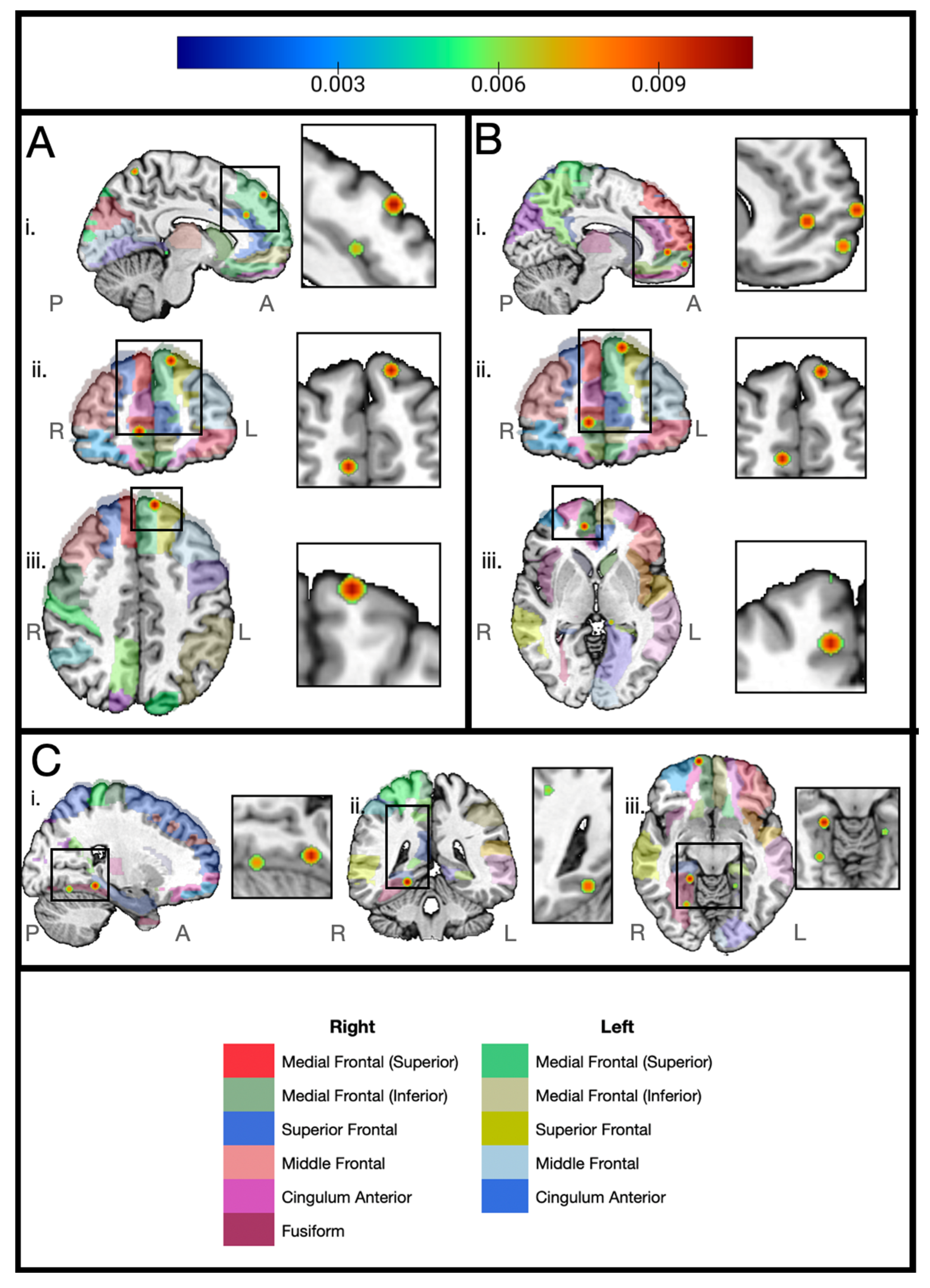 Cancers 17 01684 g004